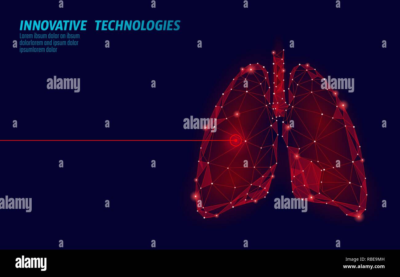 Polmoni umani la chirurgia laser funzionamento bassa poli. Malattia della medicina il trattamento con il farmaco area dolorosa. I triangoli rossi poligonale 3D render forma. Farmacia tubercolosi modello di cancro illustrazione vettoriale Illustrazione Vettoriale