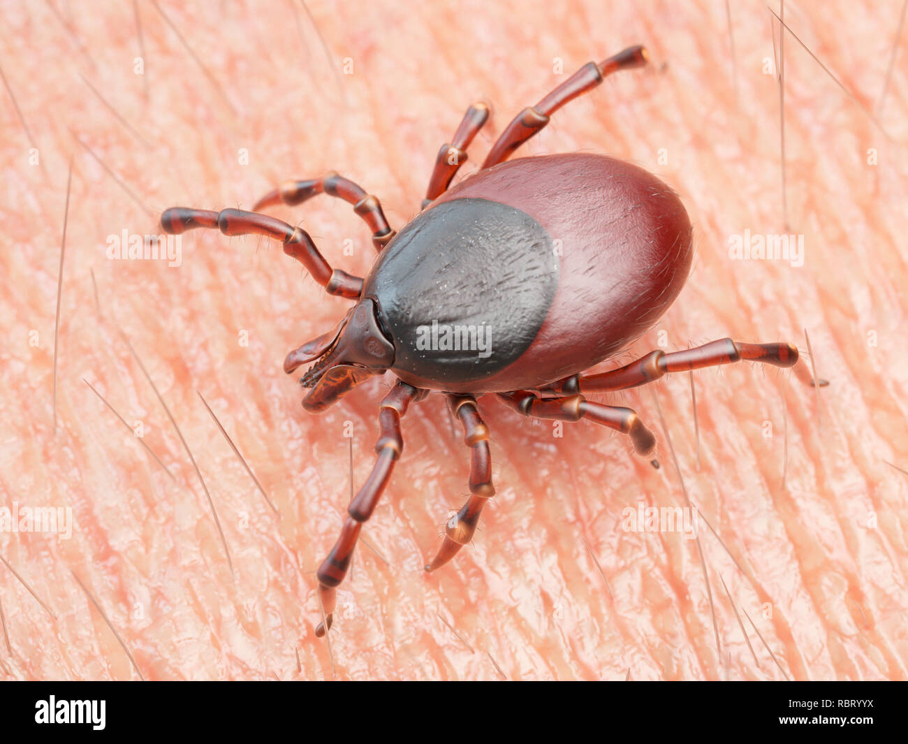 Illustrazione di un tick strisciando sulla pelle umana. Foto Stock