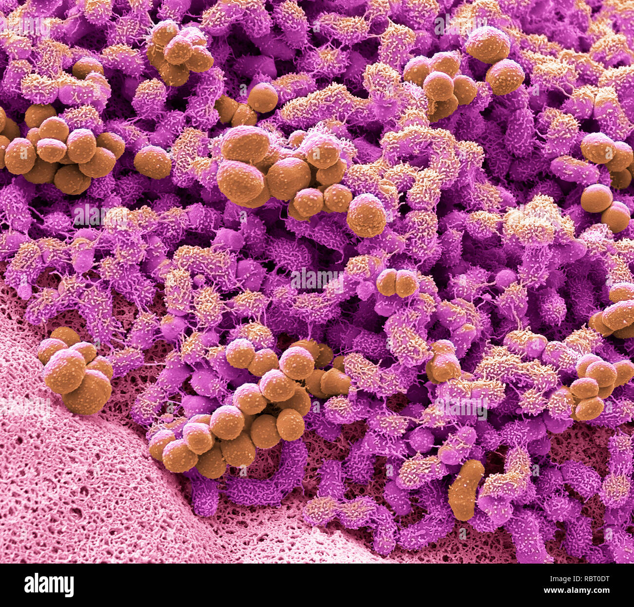 Piedi batteri. Micrografia al microscopio elettronico a scansione (SEM) di batteri che vivono su piedi umani. Tali batteri metabolizzano il sudore e altre sostanze sulla pelle Foto Stock