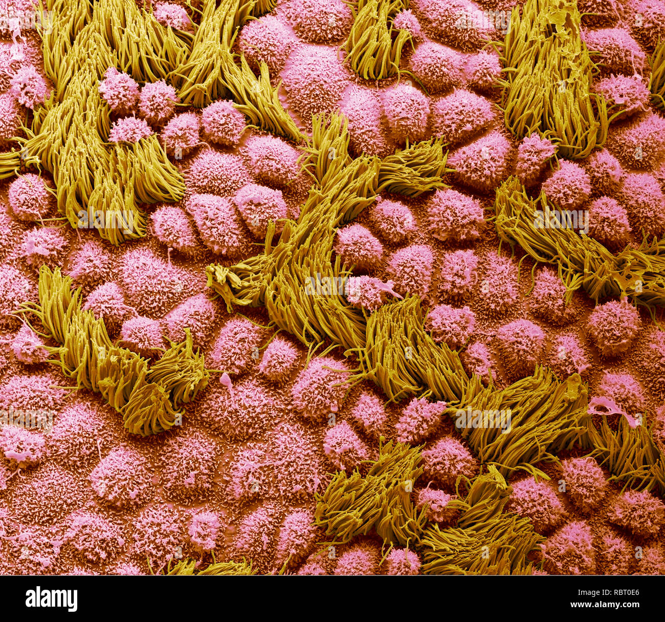 Tubo di Falloppio. Color scanning electron microfotografia (SEM) della superficie di un essere umano della tuba di Falloppio. Le tube di Falloppio sono condotti che portano da ovaie in utero. L'epitelio è costituito da cellule colonnari, molti dei quali hanno ciglia (giallo). Il battito delle ciglia è verso l'utero, favorendo il trasporto delle uova da ovaie. Di colore blu sono le cellule di secrezione con loro microvilli proiezioni. Queste cellule secernono una sostanza che mantiene un ambiente umido nel tubo e possono fornire elementi nutritivi per l'uovo. Ingrandimento: x2000 quando stampata a 10 cm di larghezza. Foto Stock