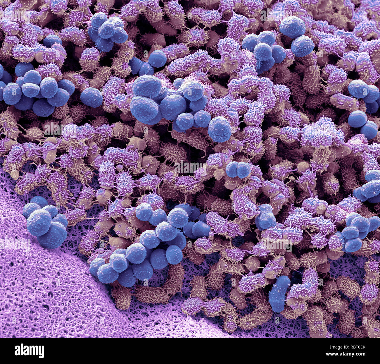Piedi batteri. Micrografia al microscopio elettronico a scansione (SEM) di batteri che vivono su piedi umani. Tali batteri metabolizzano il sudore e altre sostanze sulla pelle Foto Stock