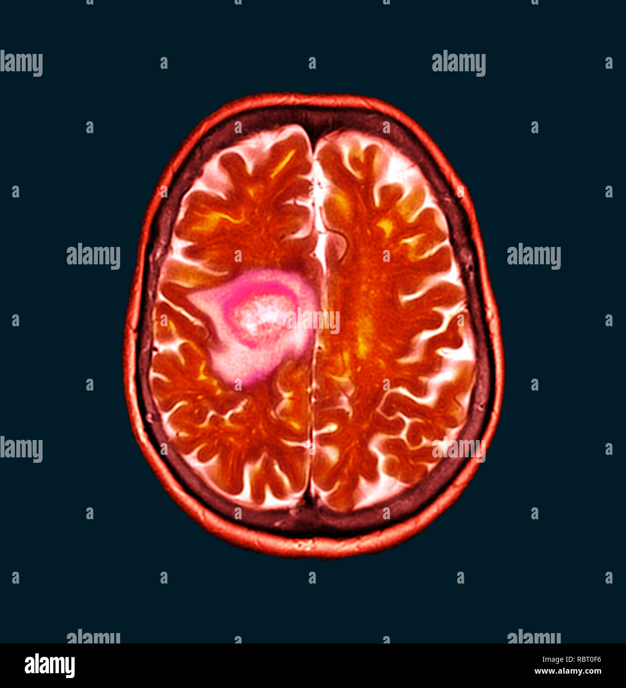 Radiografia colorata immagini e fotografie stock ad alta risoluzione