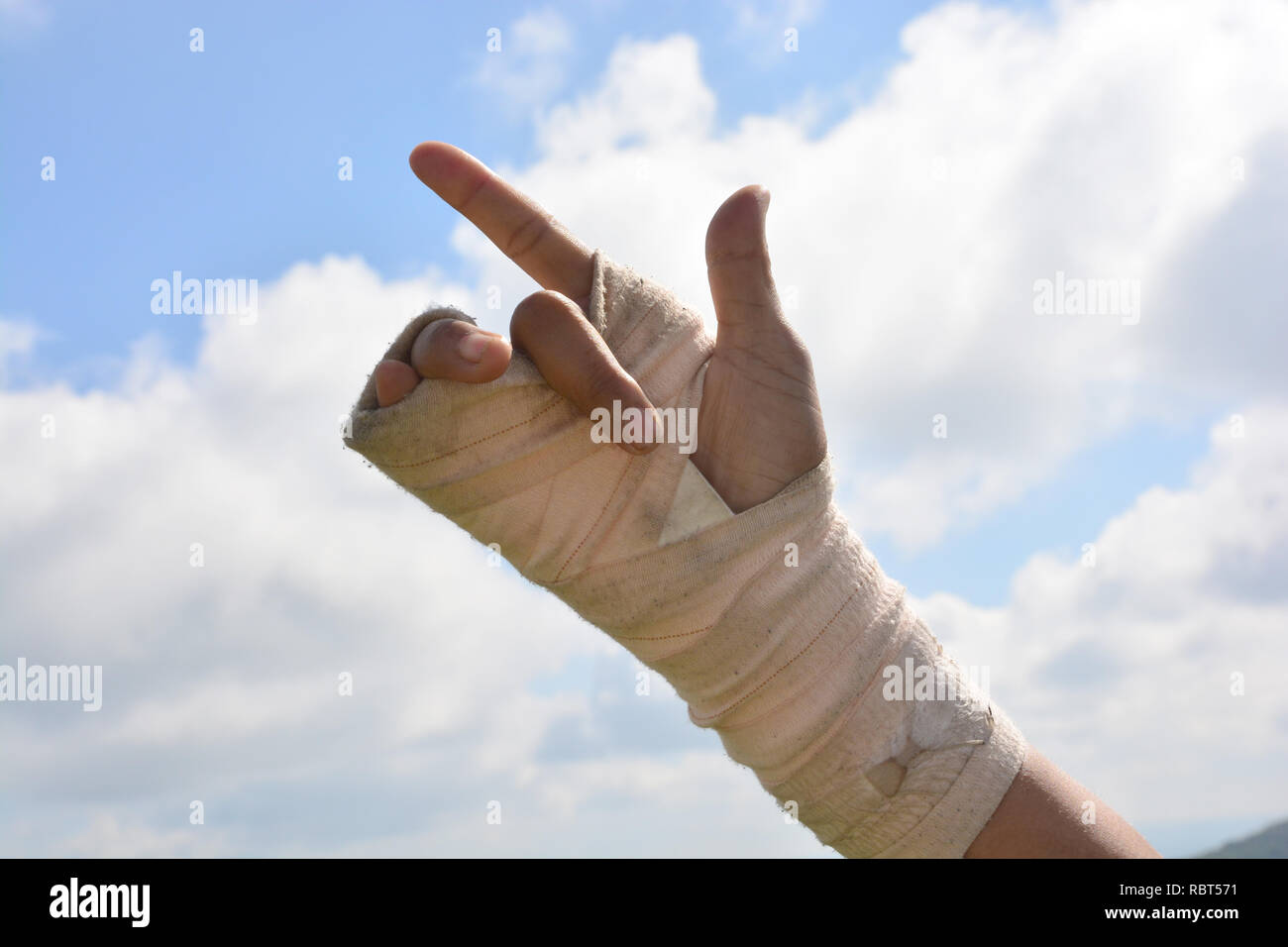 Le persone con dolori al polso in un bendaggio elastico esercizio dita con sfondo cielo Foto Stock