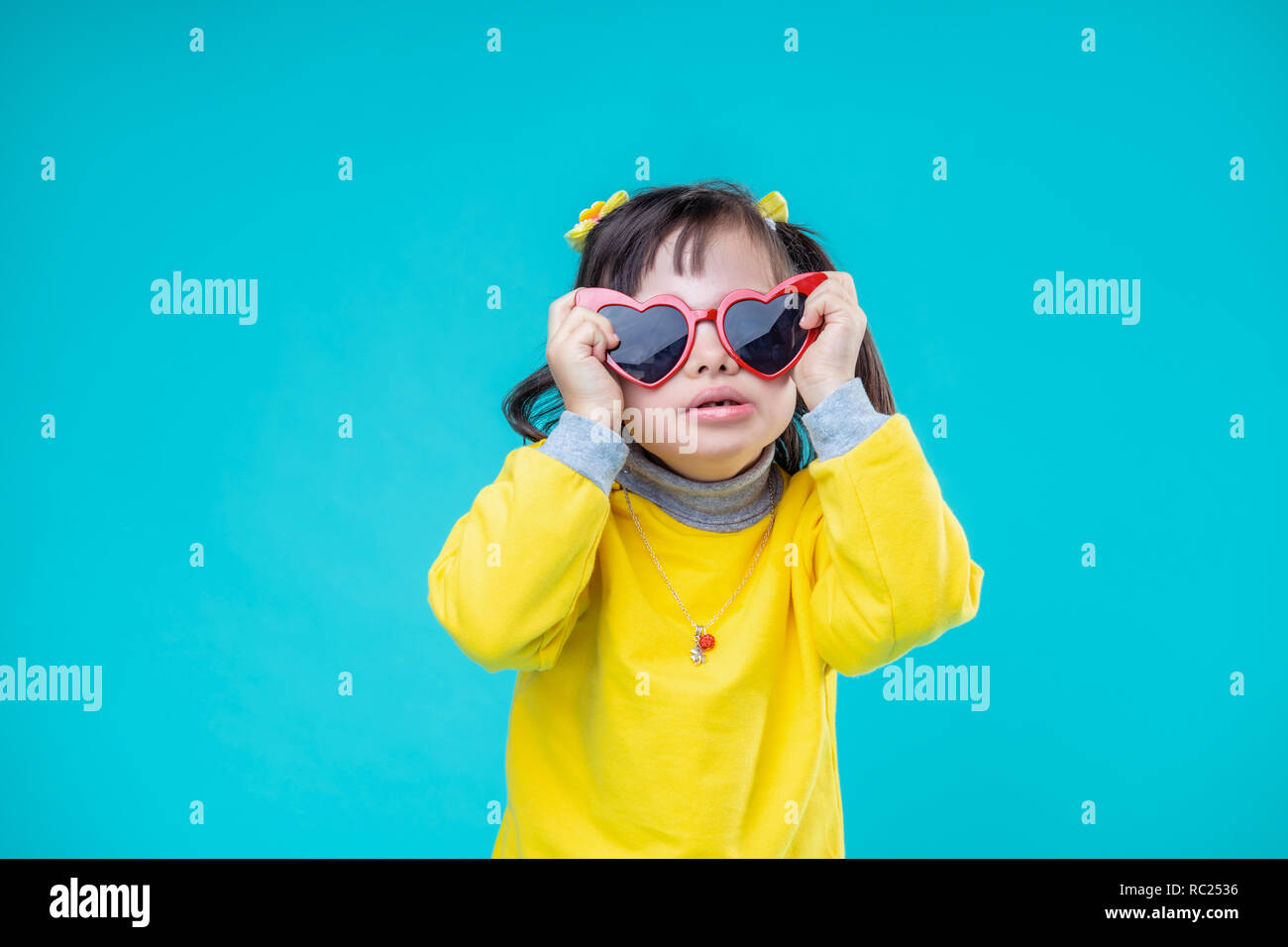 Bambina con disturbo genetico in posa di funky bicchieri Foto Stock
