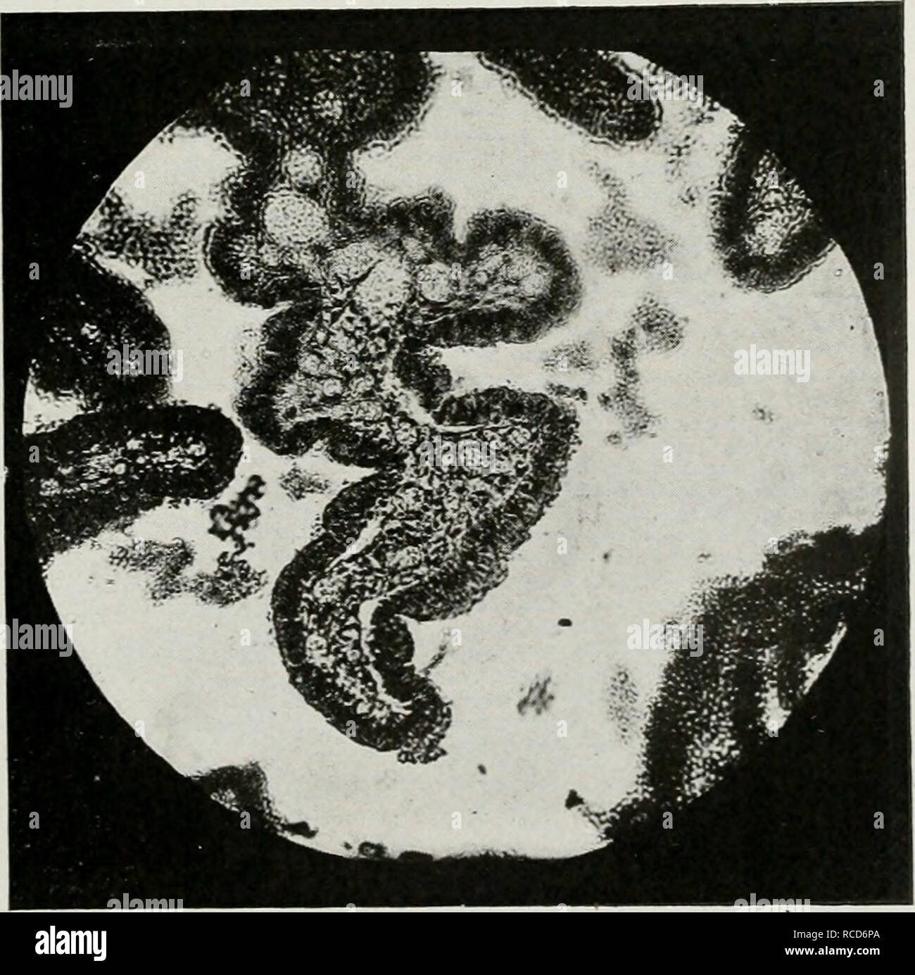 . Le malattie degli organi genitali degli animali domestici. Malattie genitali, maschio -- veterinaria; malattie genitali, femmina -- veterinario. Fig. 149-catarrali croniche salpingite. Con quasi totale occlusione. Vestigia del lume del tubo vengono mostrate da due piccole aree di nero delimitato da wliite.. Fig. 150-fortemente ingrandita piega della mucosa nella fase acuta di infiammazione, mostrando la congestione, essudazione, ecc. Si prega di notare che queste immagini vengono estratte dalla pagina sottoposta a scansione di immagini che possono essere state migliorate digitalmente per la leggibilità - Colorazione e aspetto di queste illustrazioni potrebbero non perfettamente resem Foto Stock