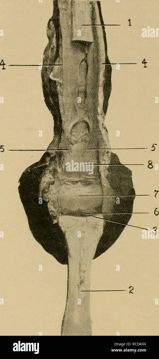 Fig. 12.-Il flessore e Perforatus Perforans flessori dei tendini. Il  metacarpo-falangea guaina e l'anello del perforatus prevista aperta  posteriormente, ed i bordi di taglio riflessa; flessori perforans tagliare  in corrispondenza circa