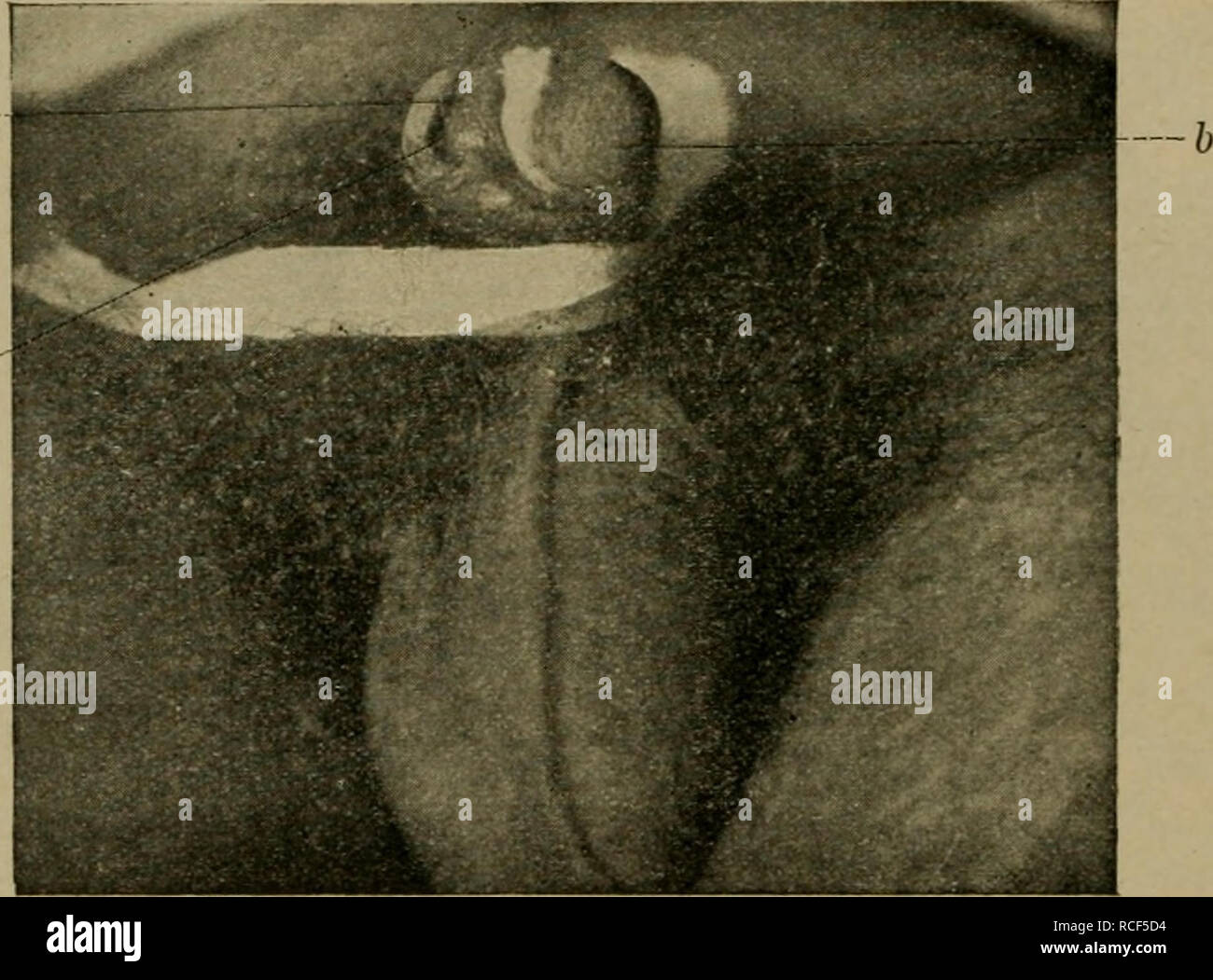 . Die vergleichende Pathologie der Haut. Dermatologia veterinaria; pelle. 598 Experimentelle la sifilide. Die Arbeiten Siegels (n. 1769) stehen im Gegensatz zu den Ergebnissen der obigen Forscher. Ich gebe im Folgenden eine Uebersicht circuizione Resultate (vgl. Fig. 166-168): für den Erreger der sifilide Siegel hält den Cytorrhyctes luis (Fig. 168). Muore pro- tozoon ist im Blut frischen syphilitischer Menschen und Affen zu bestimmten Zeiten bei stärkster Vergrößerung unter miglior Abbiendung sichtbar, unterscheidet sich von den gleich großen Hämo- konien durch deutliche Innenteilung, Eigenbewegung und Foto Stock