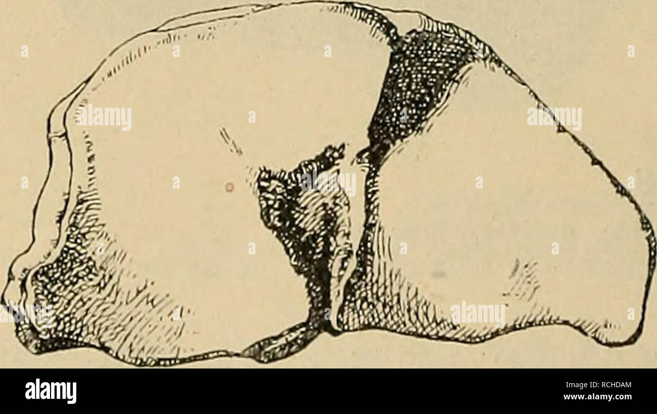 . Die Pithecanthropus-Schichten auf Java. Geologische und palÃ¤ontologische Ergebnisse der Trinil-Expedition (1907 und 1908), ausgefÃ¼hrt UnterstÃ¼tzung mit der Akademischen JubilÃ umsstiftung¤der Stadt Berlin und der KÃ¶niglich bayerischen Akademi der Wissenschaften. Geologia e Paleontologia; Homo erectus. 134 H. Stremme. hier im Gegenteil schwach vorgewÃ¶lbt. Von dieser VorwÃ¶lbung aus gegen die KÃ¶rperachse hin ist der Gelenkrand gerade abgestutzt bis zur Mittellinie des Gelenkes und verlÃ¤uft von hier im Bogen zur Hinterseite, der ebenfalls die starke Einbuchtung an der BerÃ¼hrungsstelle der Foto Stock