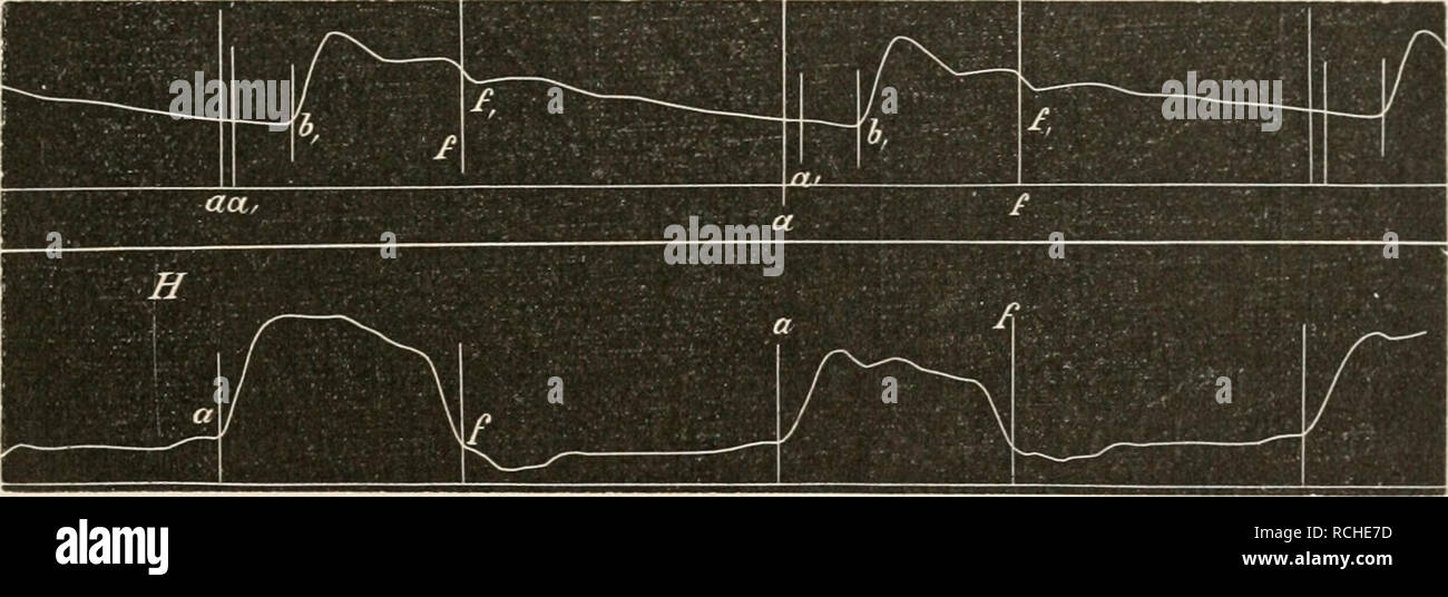 . Die Physiologie des Kreislaufes. Sistema cardiovascolare. Fig. 160. Synchronisch geschriebene Pulskurven von Karotis (die obere Linie) und Radialis (die untere Linie). Nach Edgren.. Fig. 16L Synchronisch geschriebene Kurven des Herzstoßes (//) und des Karotis- impulsi (die obere Linie). Nach Edgren. diese zeitliche Differenz Sekunde 0,0786. Die Bahn von den Semilunarklappen bis zu dem Punkt der A. carotis, deren Pulsationen geschrieben wurden, betrug etwa 20 cm, und die Bahn von den Semilunarklappen zu der A. radialis 80 cm. Der dem Unterschied gefundenen entsprechende Weg ist anche i 60 cm. Hiera Foto Stock
