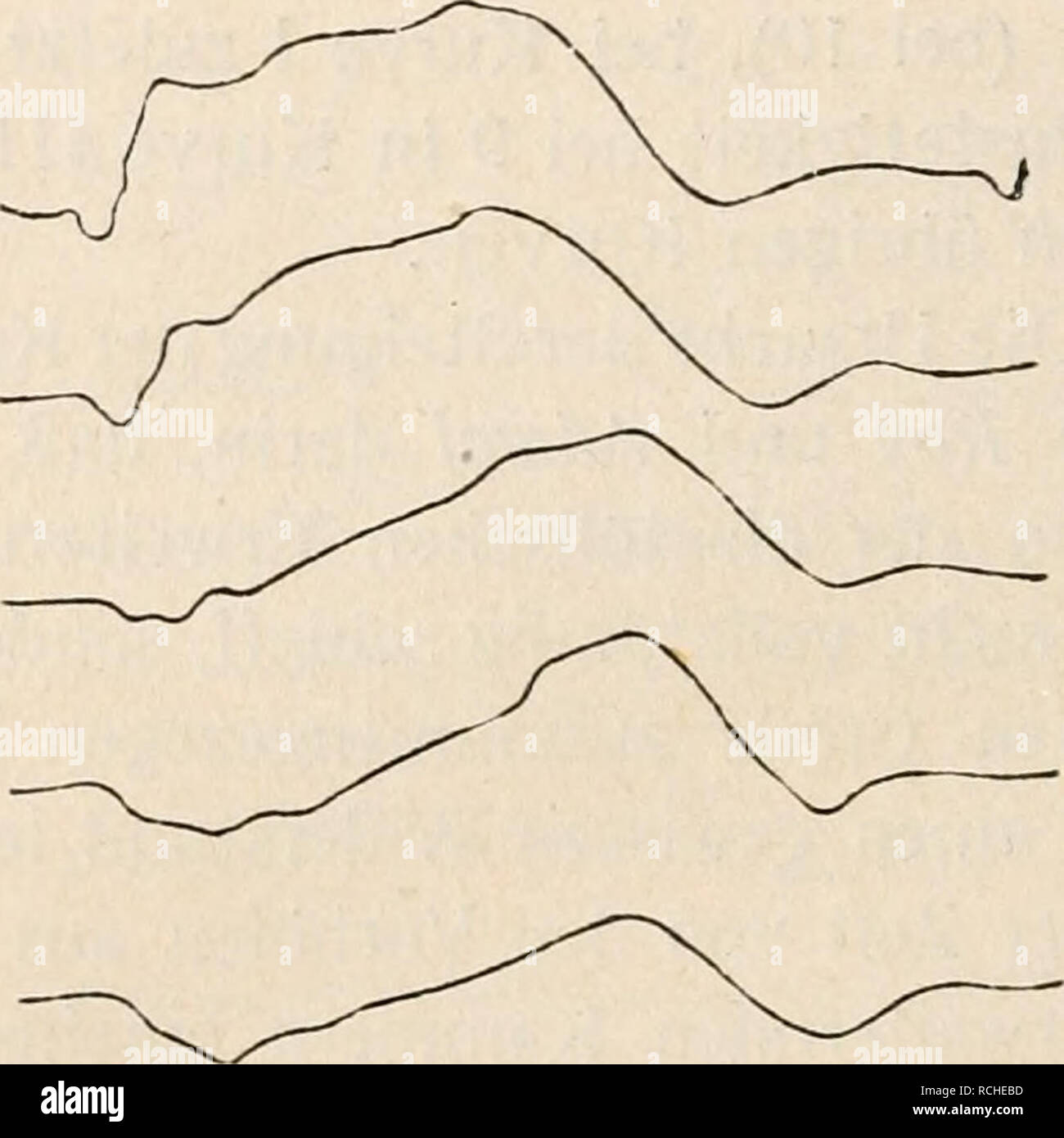 . Die Physiologie des Kreislaufes. Sistema cardiovascolare. Fig. 122. Veränderungen des Herzstoßes im Verlaufe einer Vagusreizung; die oberste Kurve ist die normale. Nach v. Frey. Fig. 123. Veränderungen des Herzstoßes im Verlaufe einer Erstickung; die oberste Kurve ist die normale. Nach v. Frey entspricht und der Herzstoß von einem bestimmten Ort, sowie bei einer bestimmten Schlagfolge aufgenommen wird, einigermaßen übereinstimmend erhalten werden kann und wir müssen v. Frey darin Recht geben, dass die einander widerstreitenden Ergebnisse der Forscher, welche sich mit dem menschlichen Kardiogr Foto Stock