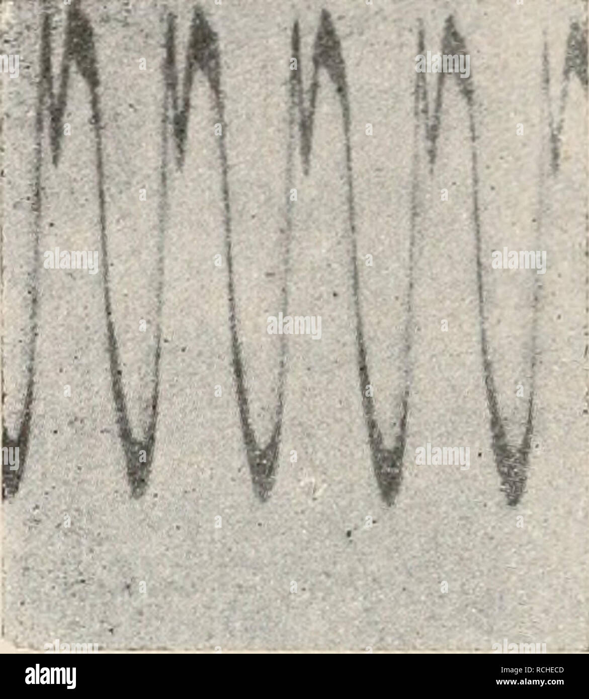 . Die Physiologie des Kreislaufes. Sistema cardiovascolare. Fig. IIOA. Intral&lt;ardialer Druck, wenn ein etwas größeres Luftbläschen in das Franksche manometro hineingekommen ist. Nach C. Tigerstedt. Vgl. mit Fig. 89. Fig.llOB. Intrakardialer Druck, wenn ein kleines Luftbläschen in das Franksche manometro hineingekommen ist. Nach C. Tigerstedt Vgl. mit Fig. 99. n i bc oder höchstens zwei, der Anfangsschwingung ganz analogen Nachschwingungen. Dieser Anstieg ist durch das Anprallen der Blutsäule gegen die geschlossenen Semilunarklappen bedingt. Hiernach geht die Kurve in den ruhigen Abfall des di Foto Stock