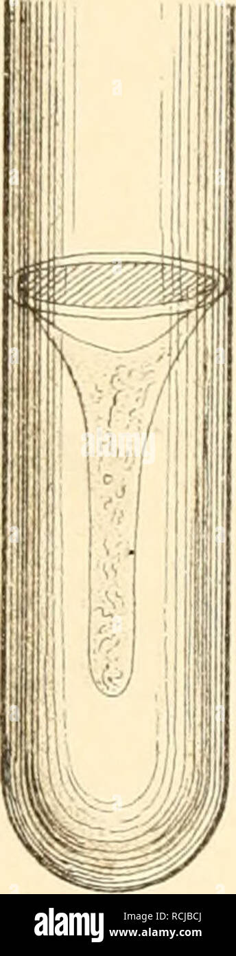 . Die mikroorganismen. Mit besonderer berücksichtigung der ätiologie der infektionskrankheiten. Batteriologia; le malattie trasmissibili. . Si prega di notare che queste immagini vengono estratte dalla pagina sottoposta a scansione di immagini che possono essere state migliorate digitalmente per la leggibilità - Colorazione e aspetto di queste illustrazioni potrebbero non perfettamente assomigliano al lavoro originale. Flügge, Karl Georg Friedrich Wilhelm, 1847-. Leipzig, F. C. W. Vogel Foto Stock