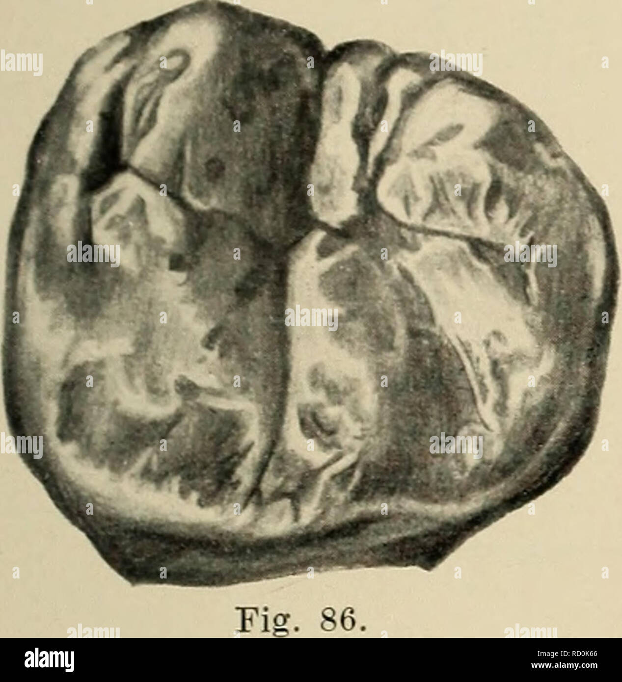 . Das Gebiss des Menschen und der Anthropomorphen; vergleichend-anatomische Unter-suchungen. Zugleich ein Beitrag zur mensch-lichen Stammesgeschichte. Denti; gli esseri umani; primati. Fig. 84 b. Figd 85 b. Fisr. 87 a. " La Fig. 87 b. f.?^. W la Fig. 88.. Si prega di notare che queste immagini vengono estratte dalla pagina sottoposta a scansione di immagini che possono essere state migliorate digitalmente per la leggibilità - Colorazione e aspetto di queste illustrazioni potrebbero non perfettamente assomigliano al lavoro originale. Adloff, Paolo. Berlino, J. Springer Foto Stock