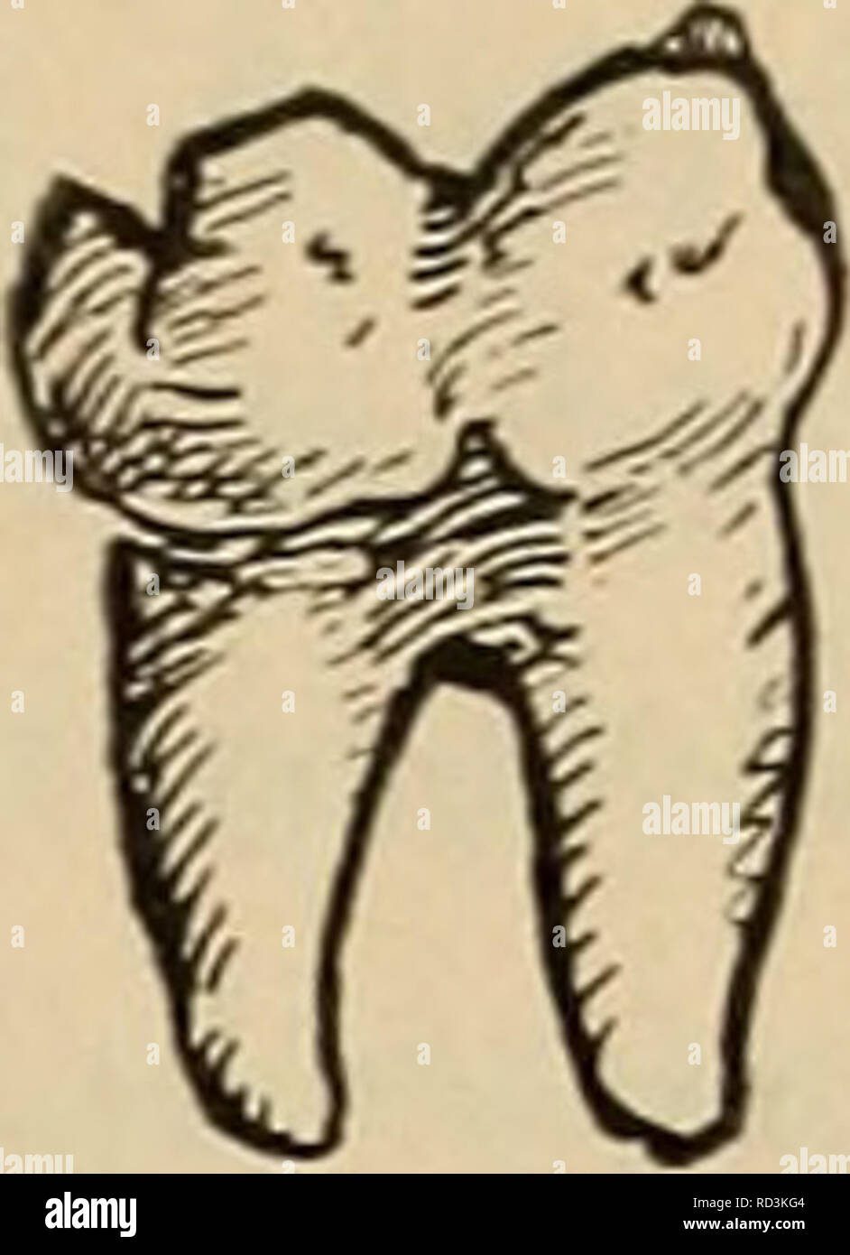 . Das Gebiss des Menschen und der Anthropomorphen; vergleichend-anatomische Unter-suchungen. Zugleich ein Beitrag zur mensch-lichen Stammesgeschichte. Denti; gli esseri umani; primati. a b c Fig. 4. Il Linker unterer M3 un des Gorilla b des Orang, c rechter unterer M3 des Schimpanse. Nur eines scheint festzustehen. Zwischen Anthropodus und Dryopithecus können keine direkten verwandtschaftlichen Beziehungen vorhanden sein. Denn ersterer primitiver ist, dabei aber in geo- logischer Beziehung jünger letzterer als, così dass er weder vor der- fahr noch ein Nachkomme von Dryopithecus sein kann. Sie könnten Foto Stock