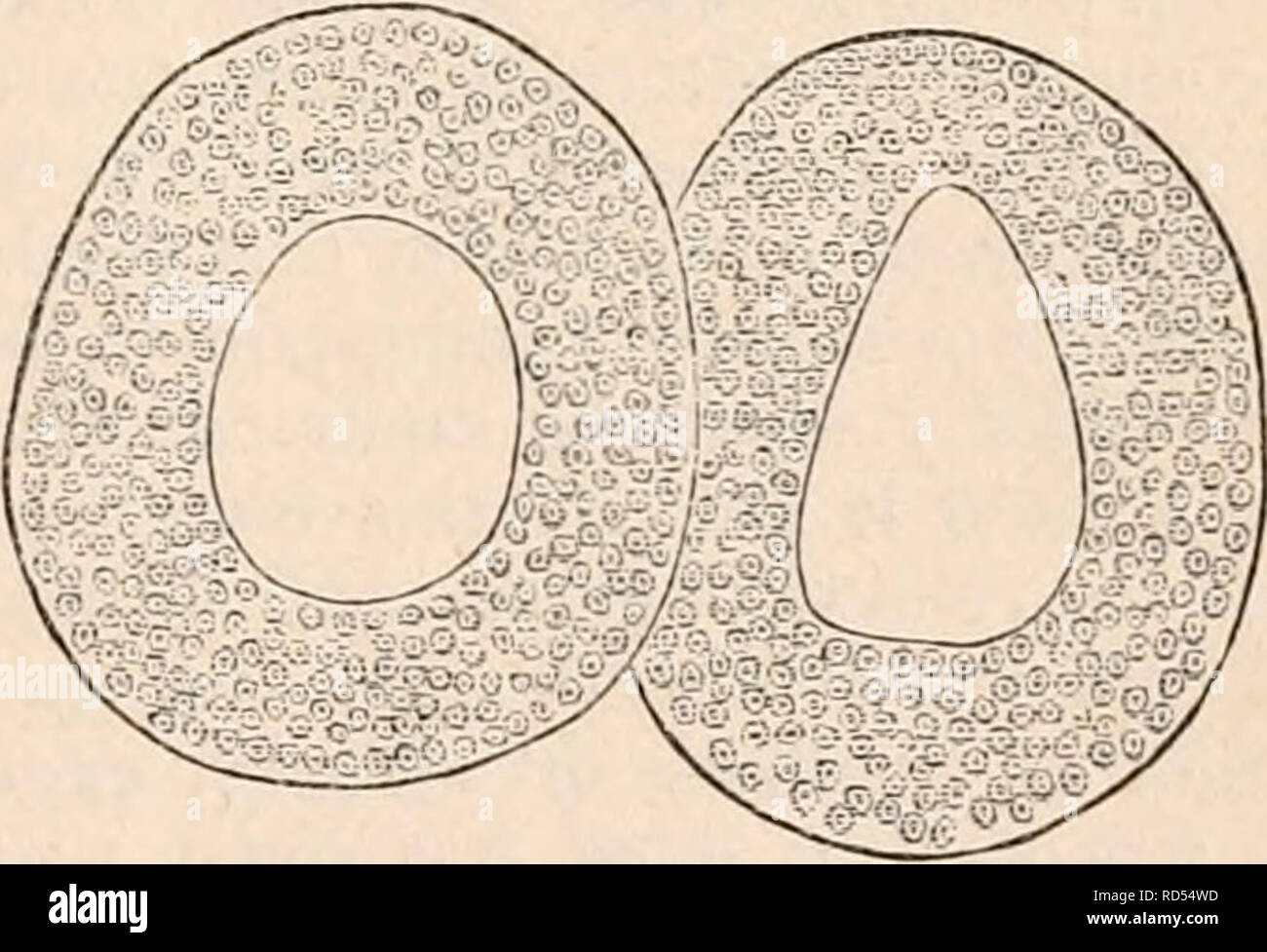 . Il encyclopaedia - Wikizionario di anatomia e fisiologia. Anatomia e fisiologia; Zoologia. O due vescicole contenente una materia trasparente e senza epitelio. Dalla tiroide di giovenco; il più grande 5^, il più piccolo in. diam. Fig. 740.. Due I'csicles dalla tiroide di Torello, avente un rivestimento più spesso di epitelio rispetto al solito, e contenenti ciascuna un singolo vescicola, la cui parete, di omo- geneous membrana, circonda la cavità centrale della vescicola originale. ben marcato, structureless busta, ma sono indigenti di qualsiasi cosa come epitelio. Essi possono essere visti solo occasionalmente all'interno delle cavità ghiandolare e un Foto Stock