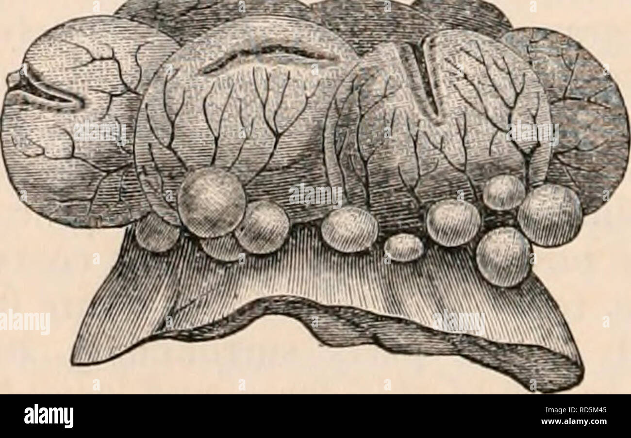 . Il encyclopaedia - Wikizionario di anatomia e fisiologia. Anatomia e fisiologia; Zoologia. Ovum del coniglio in atto di fuga da un rup- tured follicolo di Graaf. (.Dopo Barry.) la cellula uovo è circondata dalla tunica granulosa, g1, e richiama dopo che la porzione di membrana granulosa denominata retinacula, #2 ; a H, dove la rottura, ha avuto luogo il rivestimento del follicolo sono attenuati e verso questo posto numerose navi convergono. La forma e le dimensioni delle aperture da cui fuoriesce ovum varia considerevolmente. Nel coniglio che appare generalmente in forma di una piccola apertura rotonda in t Foto Stock