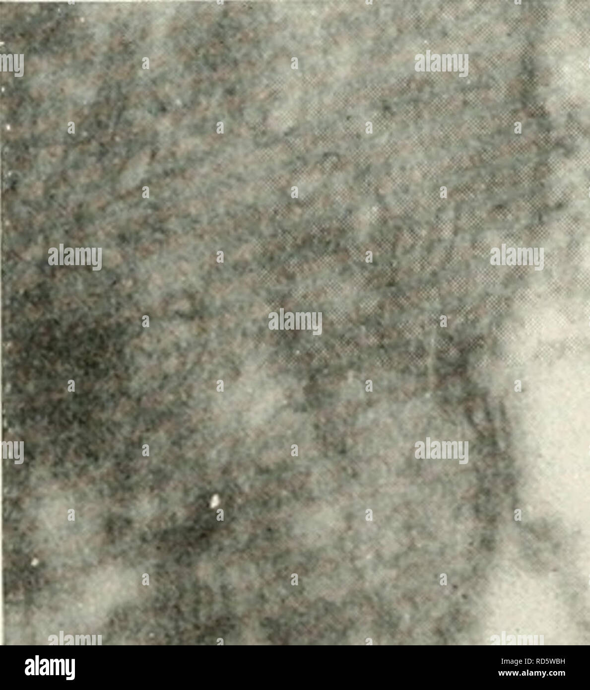 . Microscopia elettronica; il procedimento della Conferenza di Stoccolma, Settembre, 1956. Microscopia elettronica. f^ ^^y^lfj J % ^^ â '.' &gt;â ¢, t 1^ A: Fig. 3. Un doppio cono. Il tratto interno della parte prossimale di una cella e parte del tratto interno della cella distale. Il bando di gara ditVerence del citoplasma in due celle. Magnifica- tion X 5600. che delle membrane del plasma in corrispondenza retinica contatti sinaptici (6). Studi di elettrofisiologia da Svaetichin (8) per- formata sul twin coni nella retina di pesce hanno dato sostegno alla interpretazione dei coni gemelli come rappresentativo di un sistema che è stimolata da due compl Foto Stock