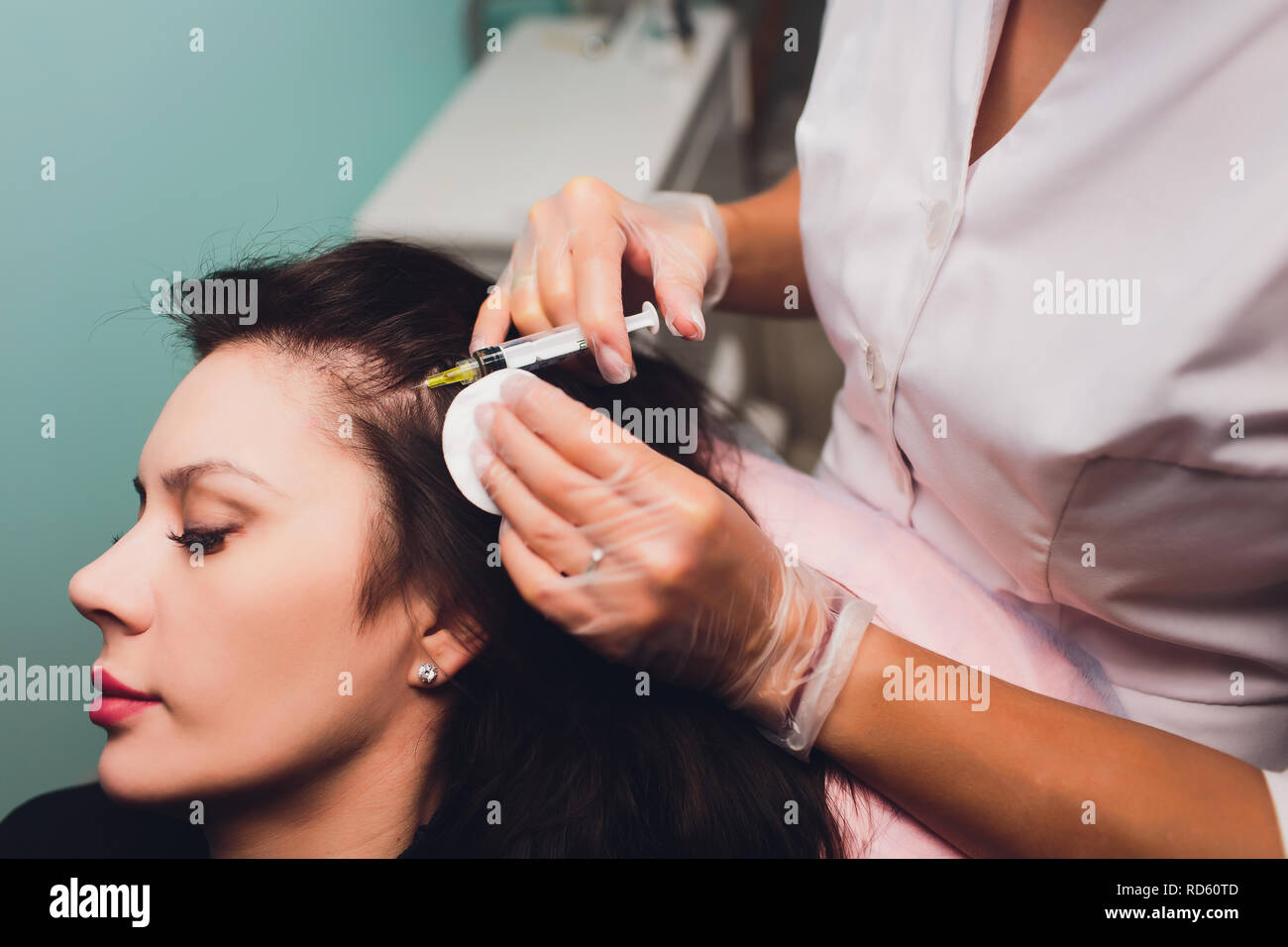 Il plasma ricco di piastrine procedura di iniezione. La crescita dei capelli stimolazione. La terapia con PRP processo. Foto Stock
