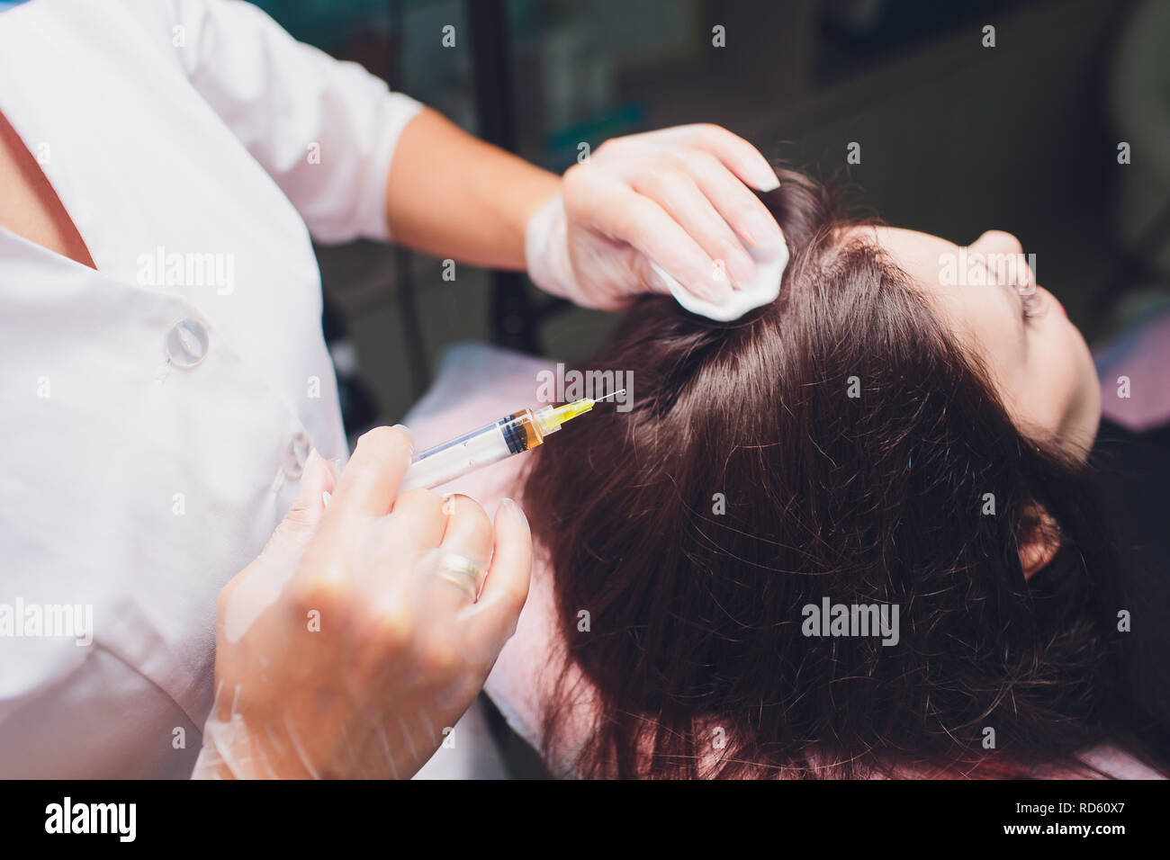 Il plasma ricco di piastrine procedura di iniezione. La crescita dei capelli stimolazione. La terapia con PRP processo. Foto Stock