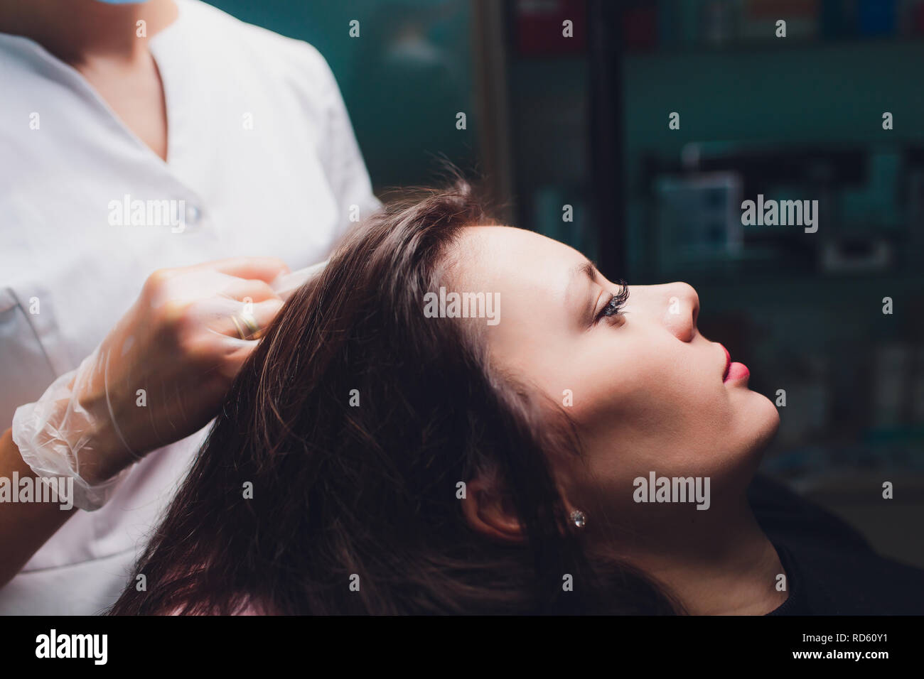Il plasma ricco di piastrine procedura di iniezione. La crescita dei capelli stimolazione. La terapia con PRP processo. Foto Stock