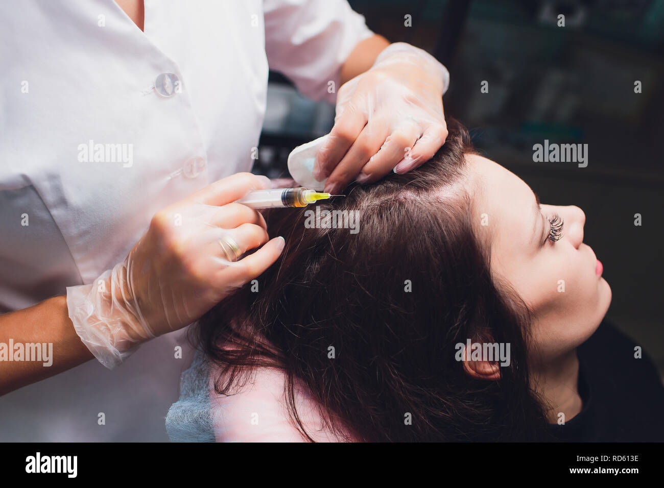 Il plasma ricco di piastrine procedura di iniezione. La crescita dei capelli stimolazione. La terapia con PRP processo. Foto Stock
