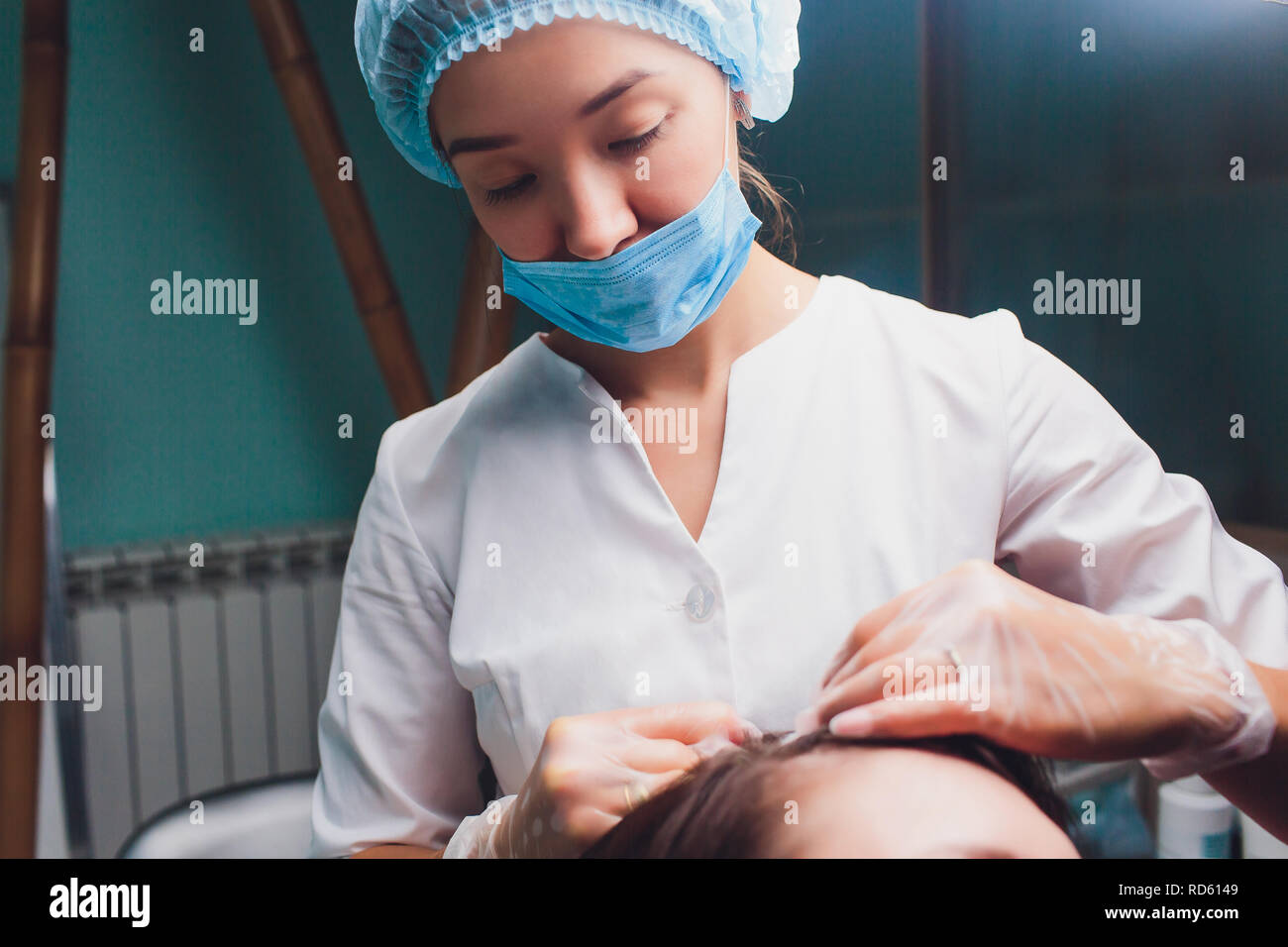 Il plasma ricco di piastrine procedura di iniezione. La crescita dei capelli stimolazione. La terapia con PRP processo. Foto Stock