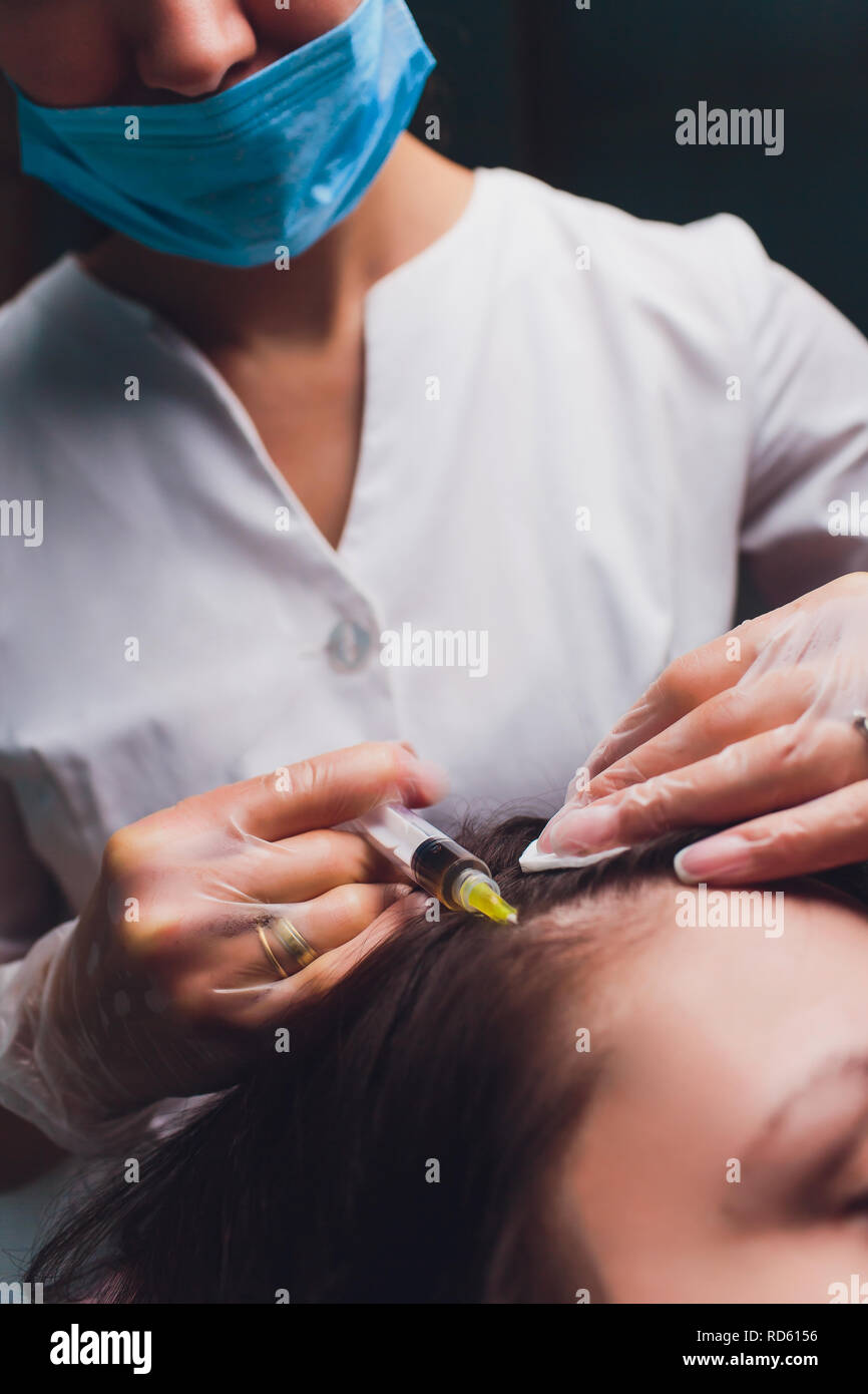Il plasma ricco di piastrine procedura di iniezione. La crescita dei capelli stimolazione. La terapia con PRP processo. Foto Stock