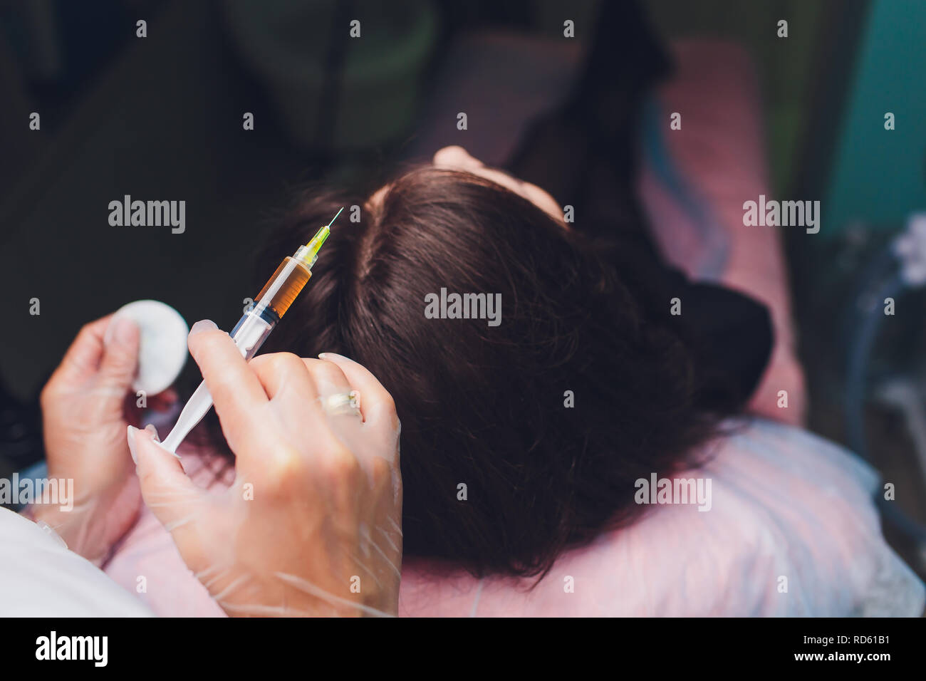 Il plasma ricco di piastrine procedura di iniezione. La crescita dei capelli stimolazione. La terapia con PRP processo. Foto Stock