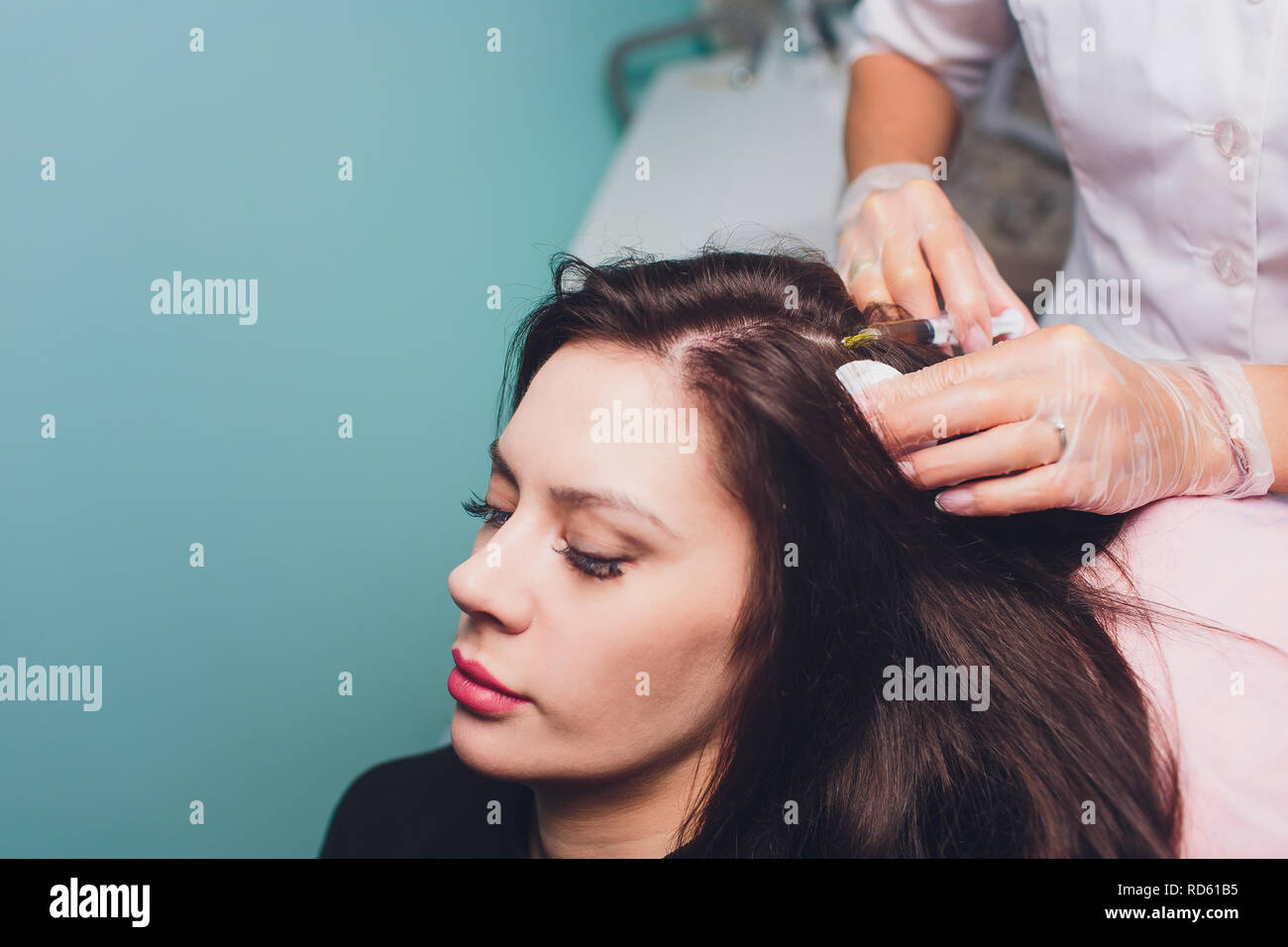 Il plasma ricco di piastrine procedura di iniezione. La crescita dei capelli stimolazione. La terapia con PRP processo. Foto Stock