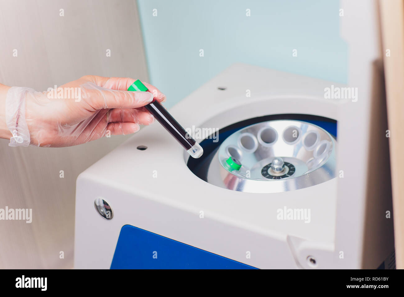 Plasma Platelet-Rich preparazione. Il tubo con il sangue nelle mani. Centrifuga. Sfondo. Foto Stock