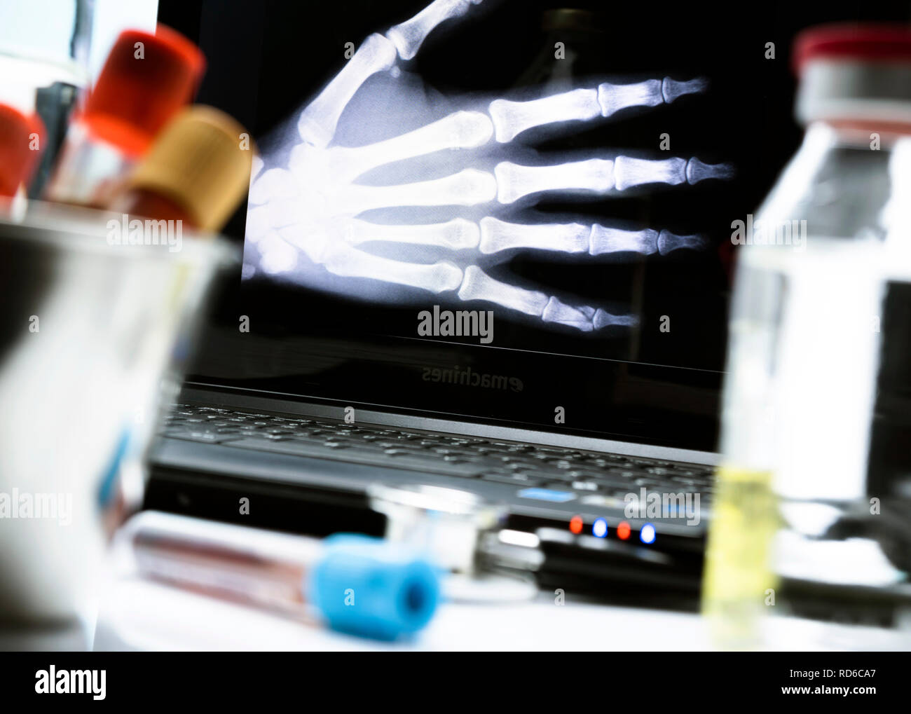 Mano radiografia in ospedale, immagine concettuale Foto Stock