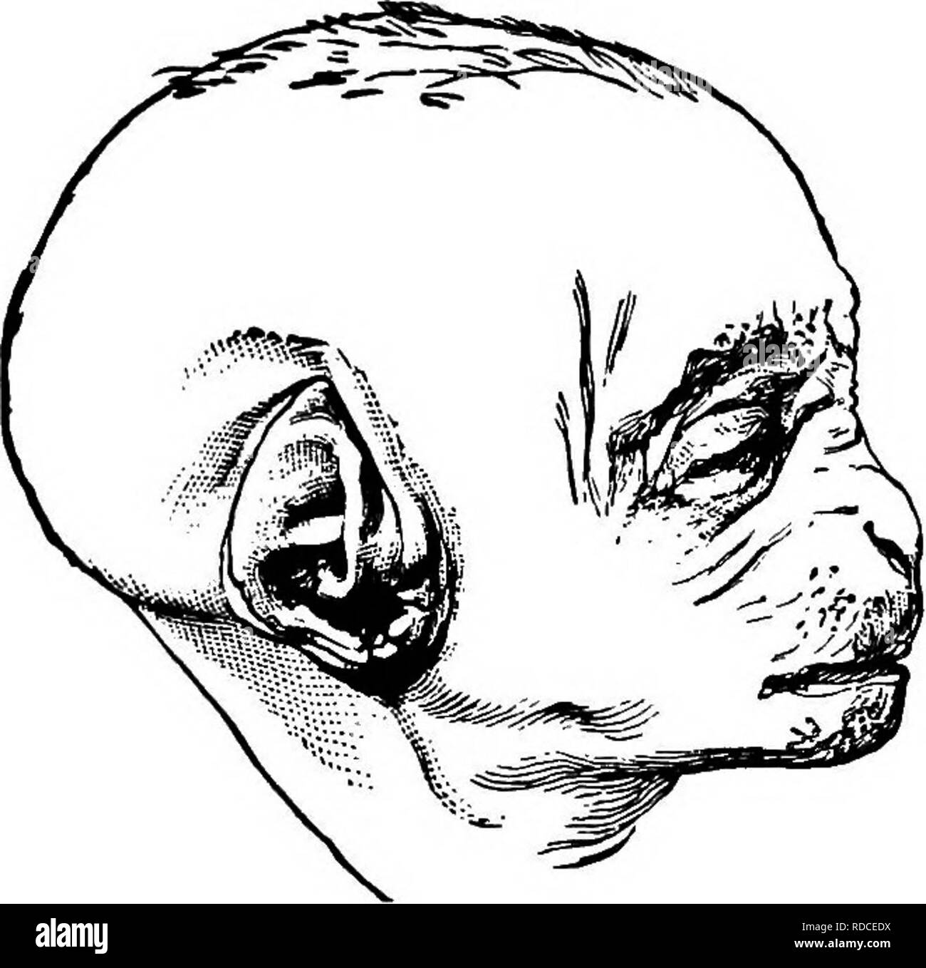 . Letture in evoluzione, Genetica ed eugenetica. Evoluzione; eredità; eugenetica. È6 letture in evoluzione, Genetica ed eugenetica. Fig. 30.-feto di un Orang. Copia esatta di una fotografia che mostra la forma di orecchio a questo stadio precoce. (Da Romanes.) la somiglianza a quella dell'uomo (comprese anche le occasionali appaiono- tanza della proiezione del punto mostrato nella precedente xilografia). È evidente che il ripiegamento della punta di un orecchio, a meno che non sia cambiato di molto durante il suo ulteriore sviluppo, darebbe luogo ad un punto sporgente verso l'interno."' la xilografia a pagina 157 (Fig. 31) serve st Foto Stock