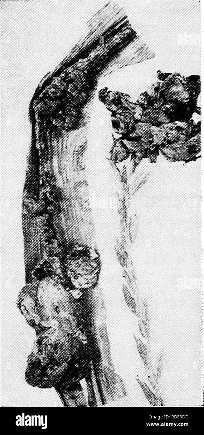 . Minnesota malattie delle piante. Le malattie delle piante. 298 Minnesota malattie delle piante. piccoli tubi che portano le spore secondario in grande abbondanza; queste spore sono in grado di lievito-come erba quando portato in condizioni favorevoli e. g., in cumuli di letame; in questo modo la capacità infettante della malattia è notevolmente aumentata. Queste spore secondario vengono trasportati dal vento o da altra agenzia di altre piante e infezione segue. Solo parti giovani delle piante può essere attaccato con successo. La malattia è solo locale nei suoi effetti e in questo carattere si differenzia molto de- cidedly da tale granello di fuliggine come lo Foto Stock