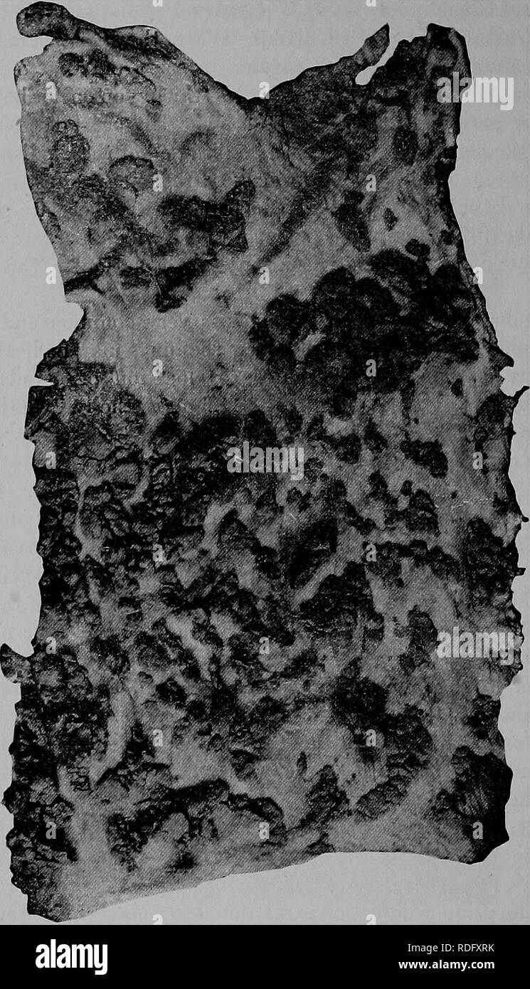 . La patologia e la diagnosi differenziale di malattie infettive degli animali : preparata per studenti e professionisti del settore della medicina veterinaria . Medicina veterinaria; malattie trasmissibili negli animali. 162 La tubercolosi. Fig. 35. una fotografia di una parte dell'omento che mostra un gran numero di piccoli più o meno appiattita tubercoli sparsi sulla superficie. (Leggermente RIDOTTO NEL SIZB). In precedenza era considerato che quando le lesioni esisteva in entrambi i grandi (addominale e toracica). cavità del corpo la malattia è stata generalizzata. È possibile, tuttavia, per poter essere generalizzato quando il les Foto Stock