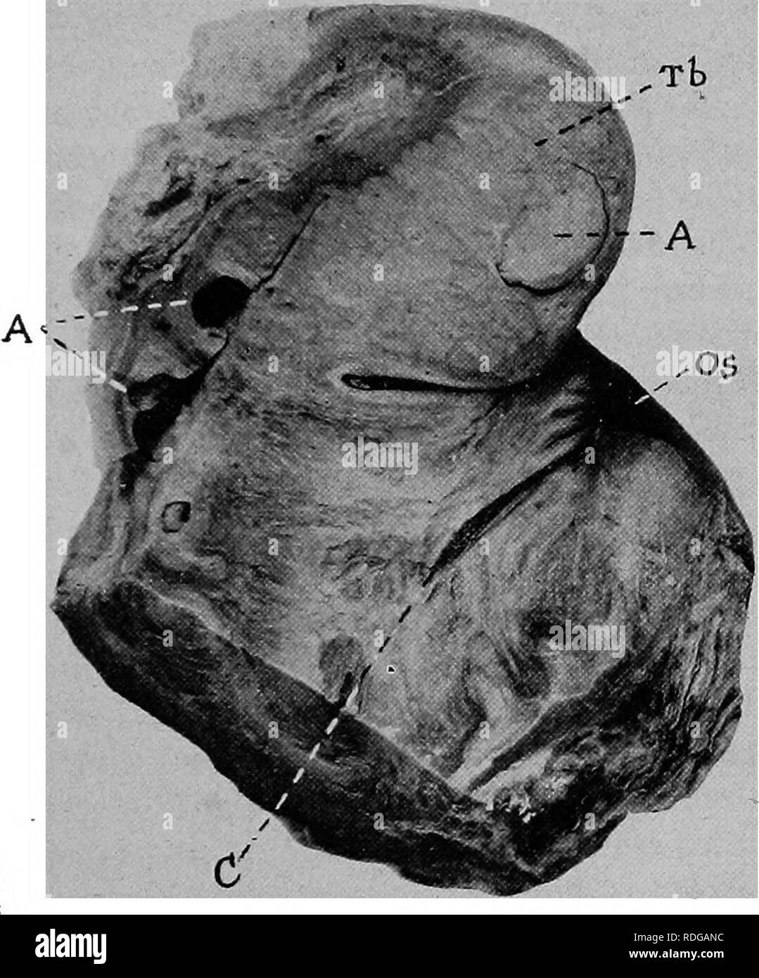 esame dei genitali femminili