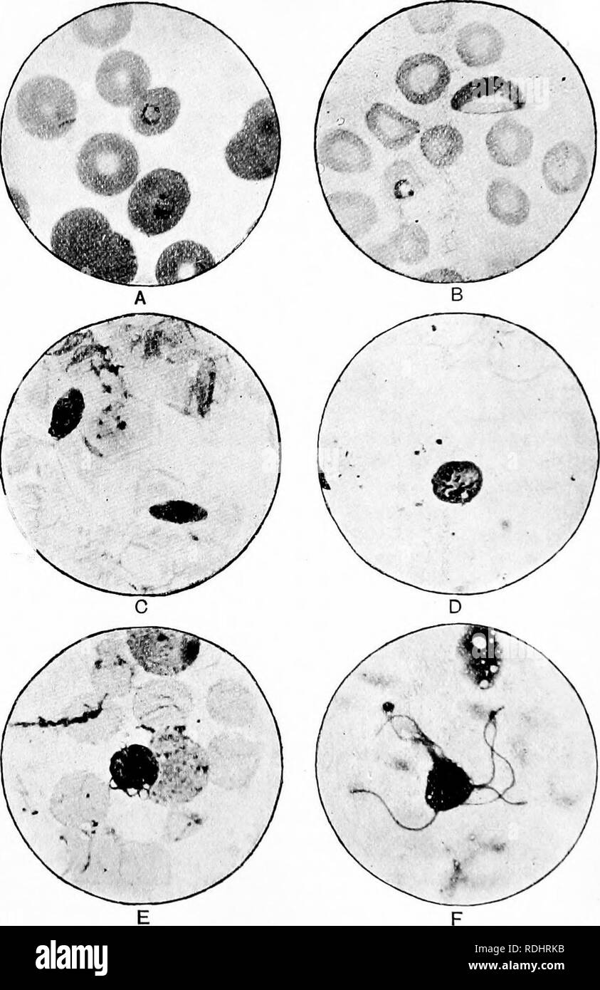 . Un manuale di zoologia elementare . Zoologia. Piastra VII.-Plasmodium falciparum, il pernicioso parassita di malaria. -Da Muir e Ritchie. Un, due piccoli a forma di anello amcebulse entro i globuli; Bt un "crescent" o gamont, mostrando la busta del rosso corpuscolare. Figg. CF illustrano i cambiamenti nella forma subita dal gamont s al di fuori del corpo ; la Fig. JF mostra un maschio gamont che ha subito ' exflagellation", o la formazione di micro- gameti, che si vedono a esso collegati. (X looo.). Si prega di notare che queste immagini vengono estratte dalla pagina sottoposta a scansione di immagini che possono essere state digi Foto Stock