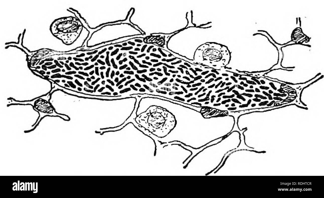 . Microbi, fermenta e stampi . Batteri; funghi; fermentazione. 144 MIOEOBES, fermenta e stampi. Probabile che abbiamo solo due forme dello stesso microbo, per il bacillus in Klein, cultura in un primo momento assomiglia Baeteriv/m termo, sotto forma di un 8 prima che essa è allungata in aste. Pasteur è riuscito a rendere le colture di microbi nella figura 8. Egli ha inoculato suina con la forma attenuata, dopo che essi sono stati. Fig. 70.-La peste suina: sezione di una ghiandola linfatica, mostrando un vaso sanguigno riempito di microbi (molto allargata: Klein). in grado di resistere alla malattia e non vi è quindi reas Foto Stock