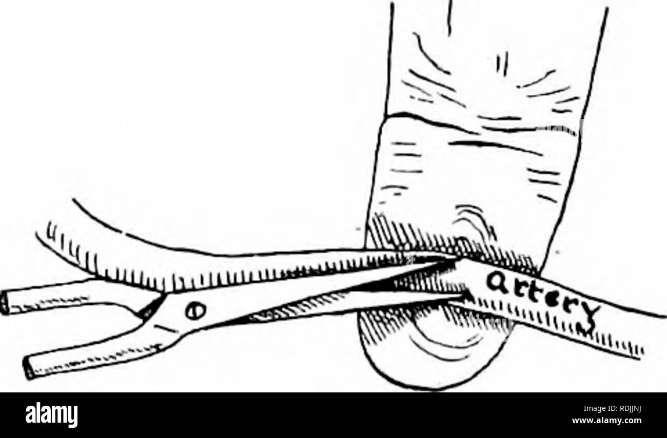 . Anatomia di mammifero : con speciale riferimento alla cat . Mammiferi, Anatomia, comparativo; gatti che pongono la giugulare esterno vene (Fig. 3). Con le pinzette ricurve sotto la spinta della vena una cordicella può essere tirato attraverso e legata in un nodo allentato. Uno-mezzo pollice da quest'ultimo una seconda corda deve essere legata intorno alla vena in modo lasco. Un taglio obliquo (Fig. 4) con il punto della forbice diretto cau- papà è quindi fatta nelle vene tra le corde. L'in- cision dovrebbe estendersi per circa a metà strada attraverso il vaso. Assorbire il sangue con cotone assorbente che corre dalla nave per prevenire ostruzioni. Foto Stock