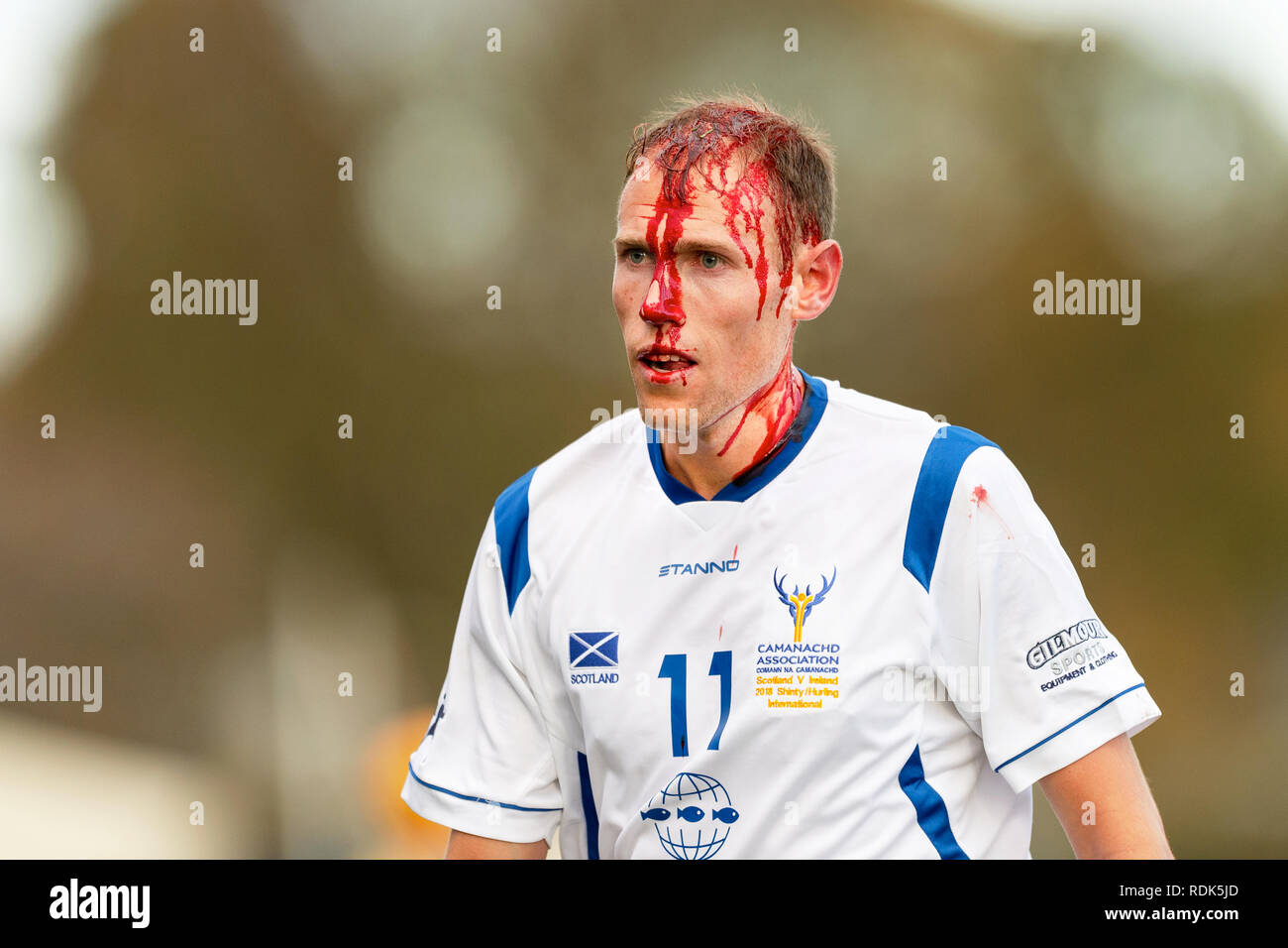 Scozia shinty team capitano Grant Irvine subisce una lesione alla testa durante il gioco. Marine Harvest Scozia v Irlanda shinty hockey irlandese international. Foto Stock