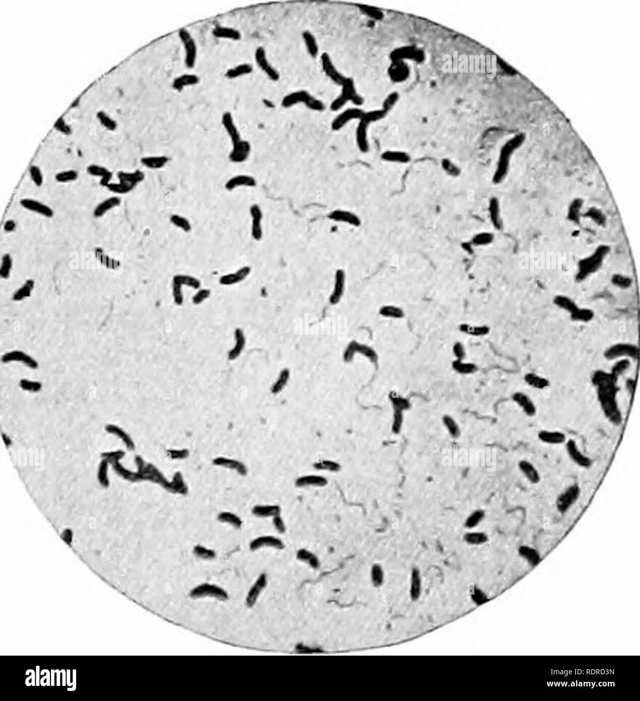 . Introduzione alla botanica. Botanica. c Fig. 133. d fz, piante di lievito, alcuni di loro germogliando; d, micrococci (singolare, Micrococcus) dall'aria; c, Bacillus subtilis, mostrando spora interna-formazione ; d, bacilli (singu- lar, bacillus) di colera asiatico, con mobili flagelli. Fotomicrografie X 740. Dopo GiJNTHER. dubbio. Si è pensato di alcuni che la maggior parte dei loro corpi è costituito di materiale nucleare. 153. Metodi di Riproduzione. - Batteri riprodurre dalla divisione, uno diventa due, due quattro e così via. Asessuale di spore sono anche formate sia da cellule normali pro-. Si prega di notare che questi ima Foto Stock