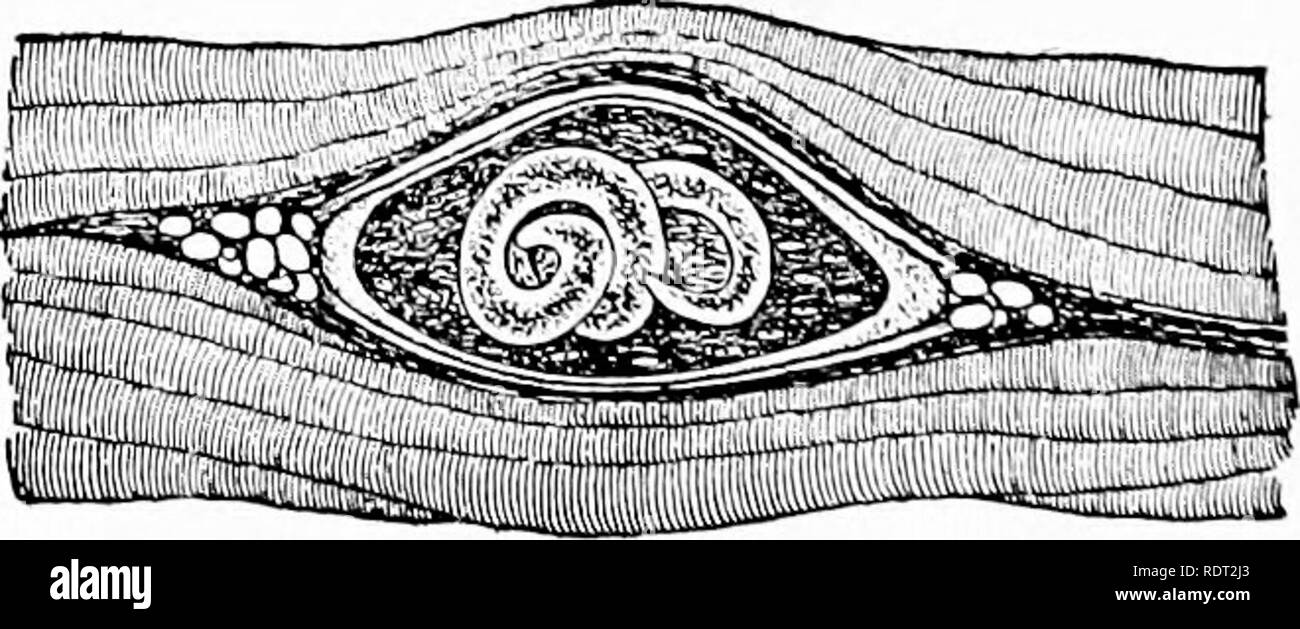 . Principi di zoo economica?logia. Zoologia, economico. Fig. 33.-pezzo di carne di maiale che mostra di larve di Trichinella spiralis encysted nel muscolo- fibre; dimensione naturale. (Ostertag.). Fig. 34.-Encysted larve di Trichinella spira- lis; ampliato. (Leuckart.). Si prega di notare che queste immagini vengono estratte dalla pagina sottoposta a scansione di immagini che possono essere state migliorate digitalmente per la leggibilità - Colorazione e aspetto di queste illustrazioni potrebbero non perfettamente assomigliano al lavoro originale. Daugherty, Lewis Sylvester, 1857-; Daugherty, L. S. , la signora , 1859-. Philadelphia, Londra, W. B. Saunders Foto Stock