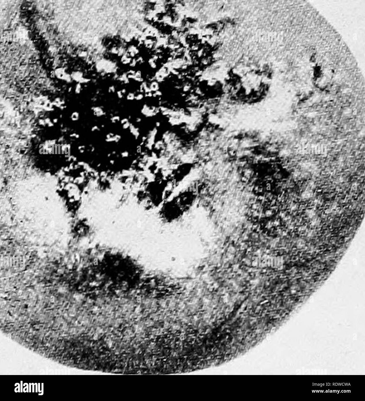 . La botanica, con applicazioni agricole. La botanica. 400 THALLOPHYTES pensato che la basidiospores ha iniziato la malattia direttamente sull'erba host, ma gli esperimenti hanno dimostrato che essi non cresceranno su questo host. Gli esperimenti hanno anche mostrato che urediniospores ordinariamente sono uccisi dal gelo e quindi raramente sono in grado di vivere su inverno dove la temperatura va molto al di sotto del congelamento. È stato suggerito che alcuni hyphae possono immettere i noccioli delle piante malate e rimane in sospeso fino a quando il seme è piantato e quindi infettare la piantina, ma questa teoria non è generalmente accettato. Foto Stock