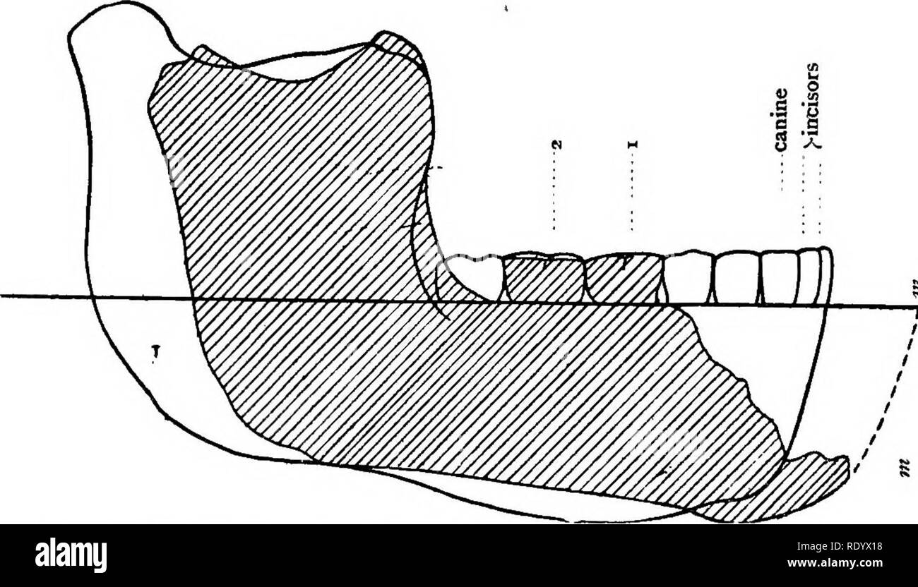 . Le deviazioni di un naturalista . Storia naturale. 286 le deviazioni di un naturalista in cui i denti vengono montati su zoccolo che deve essere abbastanza grande da occupare una lunghezza di circa due pollici e due quinti (cost- sult Fig. 2 5 e la sua spiegazione). Il dottor Smith legno- ward non ha esitato, in vista della forma della ganascia in modo strettamente simile a quello di uno scimpanzé, a postulare la. 7- B-: Fig. 25.-la ganascia Piltdown (ombreggiate) e la ganascia di Heidelberg (contorno solo) super-imposti e rispetto ponendo il iirst e secondi denti molari (l e 2) dei due esemplari in esatta coincidenza sulla linea orizzontale A, B. La dimen lineare Foto Stock