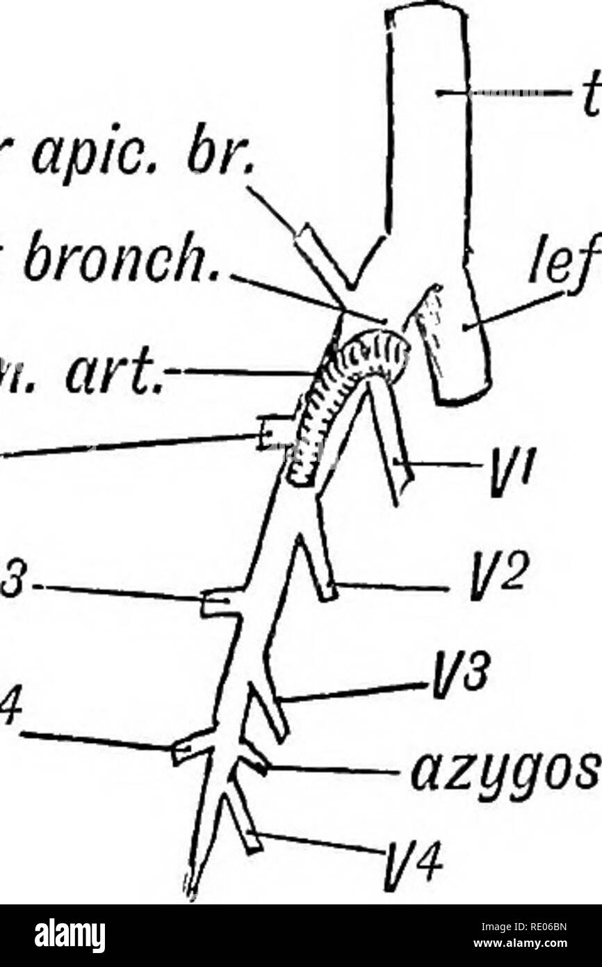 . Embriologia umana e morfologia. Embriologia umana; la morfologia. destra cardin. jiein ramo di destra.. I.- mettere. arte II. trachea Bronco sinistro I. mesoblast II. pul. le gemme III. mesoblast oesoph. Fig. 206.-La condizione dell'ansa e sinistra Pulmonarj' gemme in una quinta settimana embrione. (Dopo la sua). (1) propaggine dei bronchi.-In mammiferi quadrupedal il bronco non dividere per un processo di parità dicotomia, come nell'uomo, ma passa indietro nel polmone come un gambo principale, che. trach, ramo di sinistra. DJ o apic. br. ramo destro, destro pollm. arte D3 D*. Maiale. 207.-Regime delle diramazioni bronchiali in Quad Foto Stock