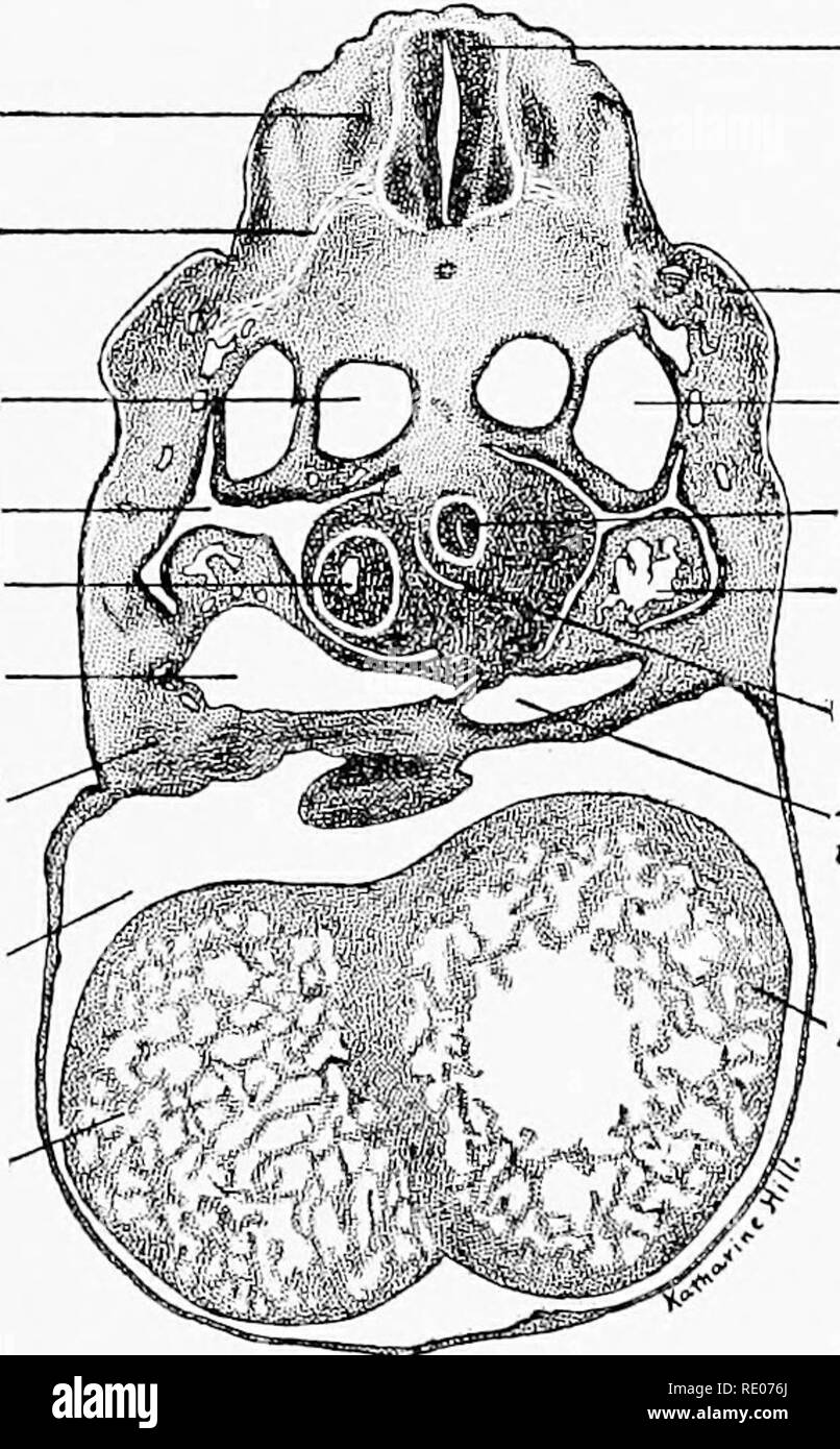 . Un manuale di laboratorio e libro di testo di embriologia. Embriologia. Jnfervenlric- ular forame cavità pericardica Fig. 104.-sezione trasversale attraverso quattro camere del cuore di un 6 mm. embrione di maiale.   Spinal Cord' ganglio spinale nervo spinale aorta discendente pleuro-peri- toneal cavità ft.polmone hud vena Rvitelline setto fransversum cavità pericardica ff.ventric/e. Arto superiore bud Post, cardinale esofago vena dorsale di fegato di lobo di Lesser sac L. vena vitelline L.VENTRICOLO X 26.5. Fig. 105.-sezione trasversale attraverso il polmone destro bud e setto transversum di un 6 mm. embrione di maiale. X 26.5.. Si prega di non Foto Stock