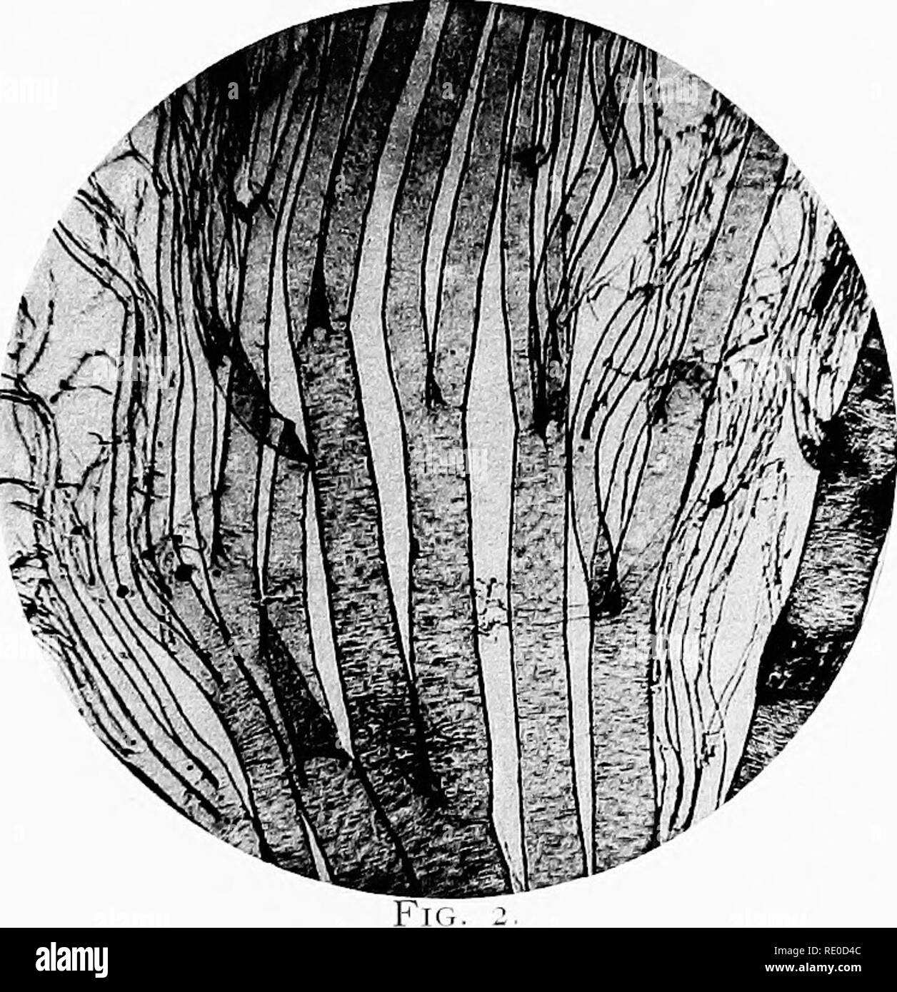 . Foto-micrografici e come farli. La microfotografia. Piastra XX. Fig. ho .. Si prega di notare che queste immagini vengono estratte dalla pagina sottoposta a scansione di immagini che possono essere state migliorate digitalmente per la leggibilità - Colorazione e aspetto di queste illustrazioni potrebbero non perfettamente assomigliano al lavoro originale. Sternberg, George Miller, 1838-1915. Boston, J. R. Osgood e azienda Foto Stock
