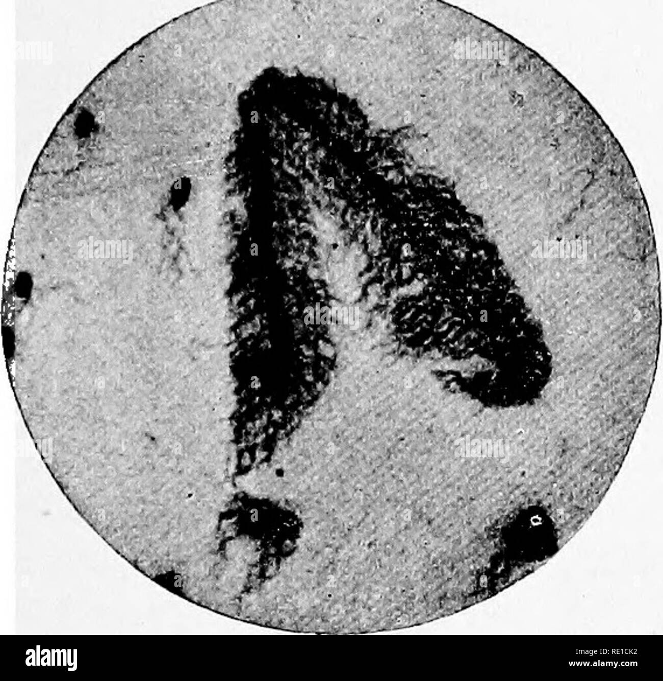 . Un libro di testo su batteri patogeni e protozoi per gli studenti di medicina e medici. Batteriologia; batteri patogeni; protozoi. Bacillus Proteus vulgaris 335 mai putrefactive change è in corso. È un errore comune per il principiante di guardare su di essa come un membro del bacillo coli gruppo. Morfologia.-l'bacilH sono variabili nelle dimensioni e nella forma-pleo- morphic-e sono denominati proteus da questa peculiarità. Alcune si differenziano molto poco da cocci, alcuni sono più simili a colon bacillus in forma, altri fanno lunghi filamenti, e occasionali spirulina forme vengono soddisfatte con i. Vero spirali non sono mai Foto Stock