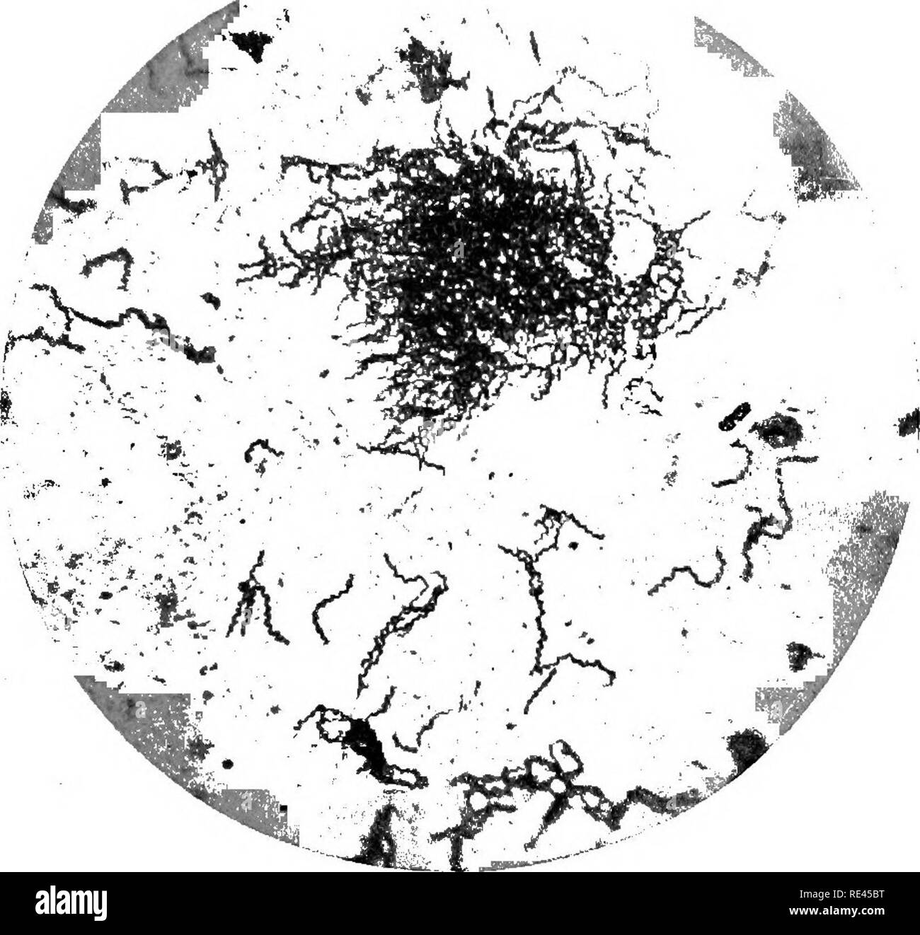 . Un libro di testo su batteri patogeni e protozoi per gli studenti di medicina e medici. Batteriologia; batteri patogeni; protozoi. La colorazione 721 Burri* ha raccomandato un metodo semplice e rapido di demon- strating il treponema e altri organismi analoghi mediante l'uso di inchiostro di china. Una goccia di succo è schiacciato da un chancre o mucose patch e miscelato con una goccia di inchiostro di china e tlien disteso su di un vetro sHde come nella realizzazione di una diffusione di una goccia di sangue. Come l'inchiostro asciuga lascia un nero o marrone scuro campo su cui la spirale organismi spiccano come shining, incolore e quindi conspicuo Foto Stock