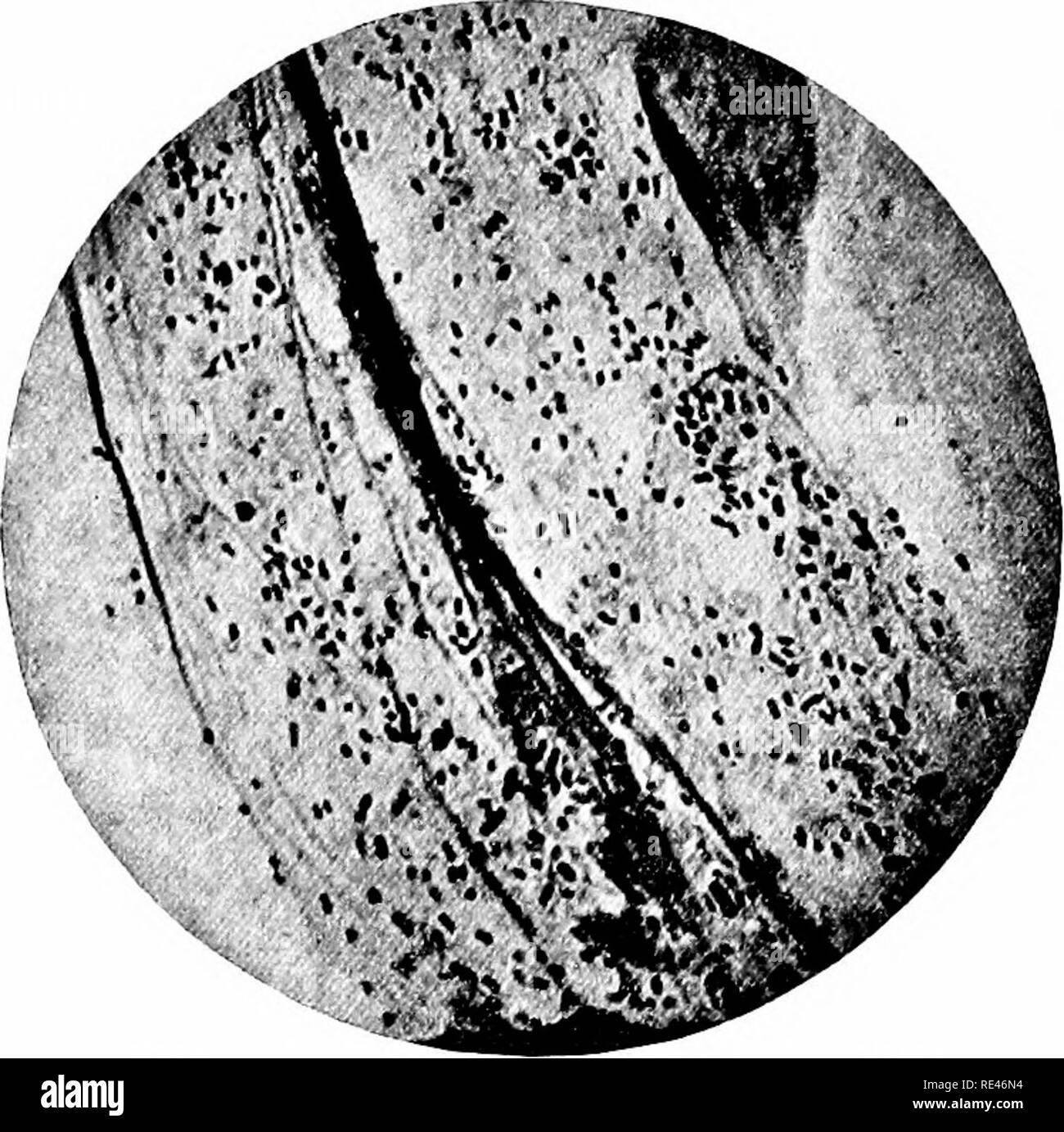 . Un libro di testo di batteriologia; un Trattato pratico per studenti e professionisti del settore della medicina. Batteriologia. 538 microorganismi patogeni su agar, la cui superficie era stato cosparso con alcune gocce di sangue prelevato da sterile il dito. L'emoglobina separati dalle cellule rosse del sangue è stata trovata essere molto efficiente come il sangue intero. Questo metodo di Pfeiffer è ancora quello più frequentemente impiegati per l'isolamento e coltivazione. Il sangue intero prelevato da dito può essere spalmato sulla superficie di si inclina o piastre, o miscelato con la carne fuso-agar di infusione. Per isolare dal spu Foto Stock