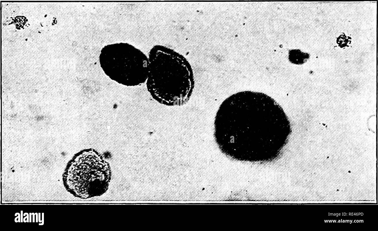 . Un libro di testo di batteriologia; un Trattato pratico per studenti e professionisti del settore della medicina. Batteriologia. 410 microorganismi patogeni da feci mediante l'uso dell'Endo fucsina-agar. Emulsioni di feci sono realizzate in tubi di brodo ordinario nel modo descritto in con- radi-metodo di Drigalski e sbavature di questa emulsione sono realizzati su piastrine di fucsina-agar per mezzo di una macchiatura di vetro asta. Il numero di colonie di Bacillus coli, dopo diciotto o più ore di incubazione, sarà trovato hanno portato indietro di un colore rosso intenso al mezzo, considerando che il tifo le colonie sono più piccole e più tr Foto Stock